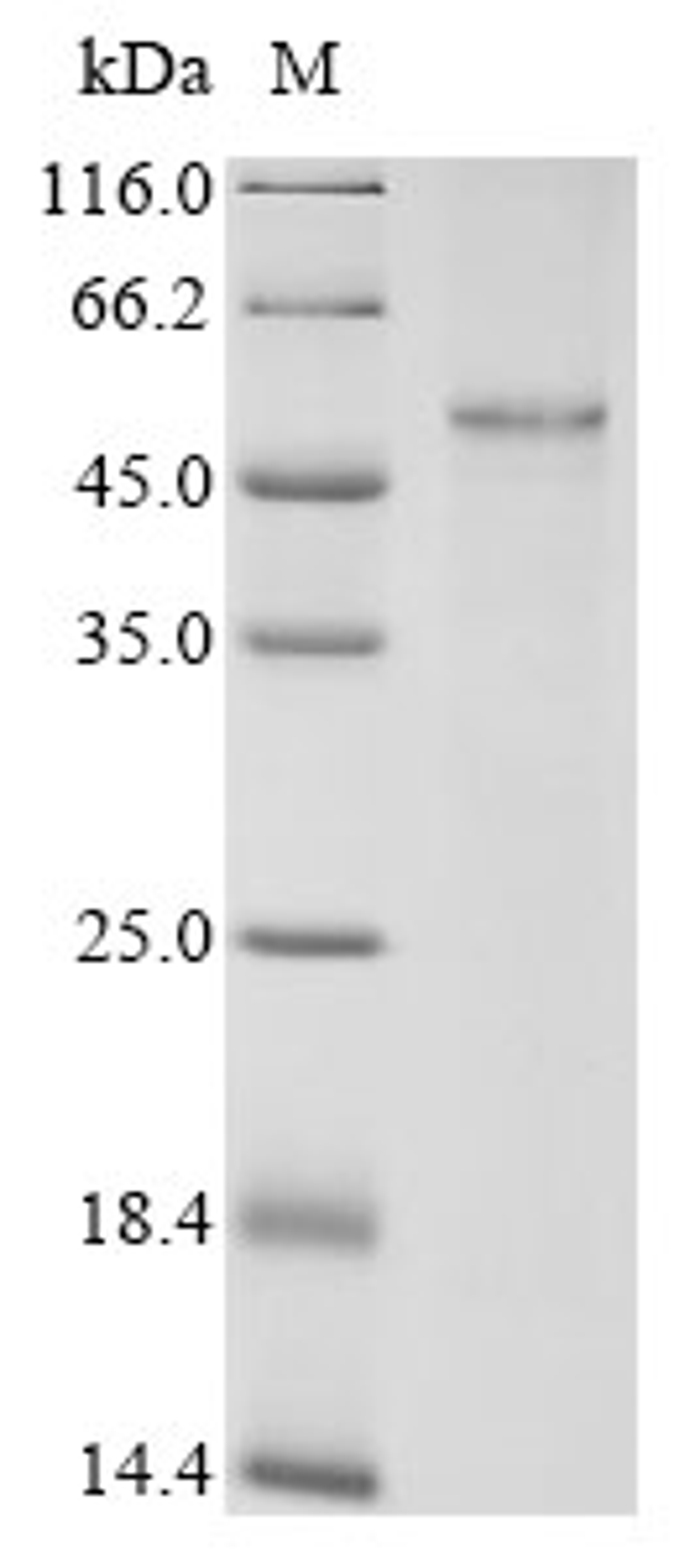 (Tris-Glycine gel) Discontinuous SDS-PAGE (reduced) with 5% enrichment gel and 15% separation gel.