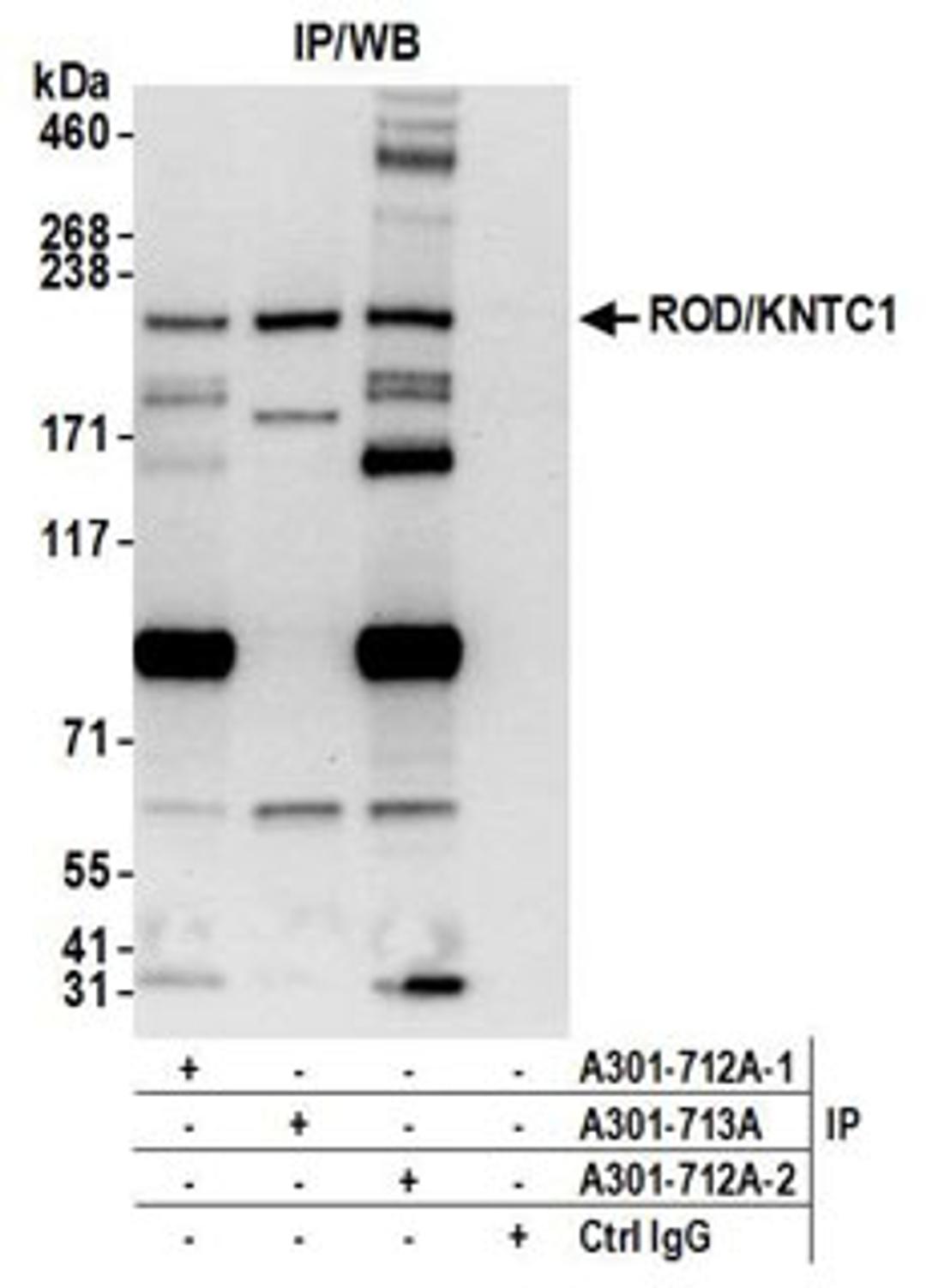 Detection of human ROD/KNTC1 by western blot of immunoprecipitates.