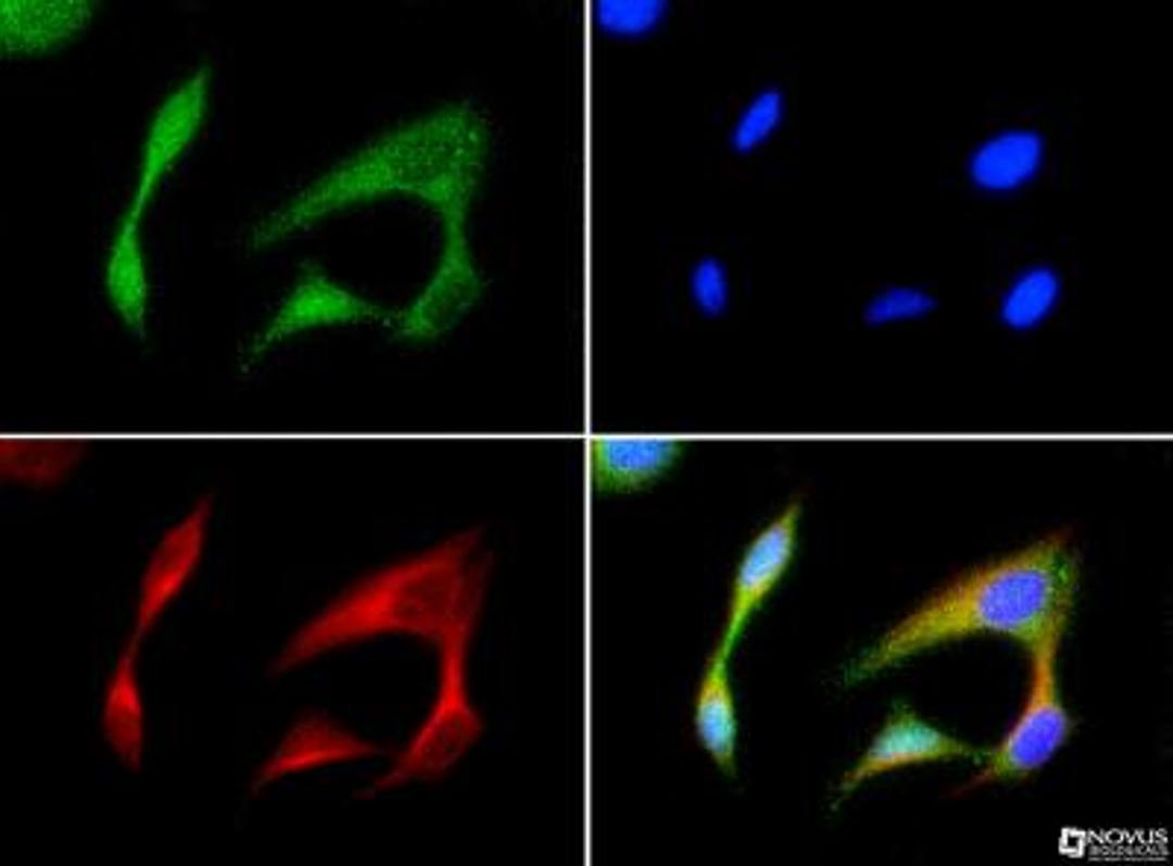 Immunocytochemistry/Immunofluorescence: N-Cadherin Antibody (13A9) [NBP1-48309] - N Cadherin antibody was tested in HeLa cells with FITC (green). Nuclei and alpha-tubulin were counterstained with Dapi (blue) and Dylight 550 (red).