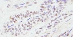 Detection of human CBP by immunohistochemistry.