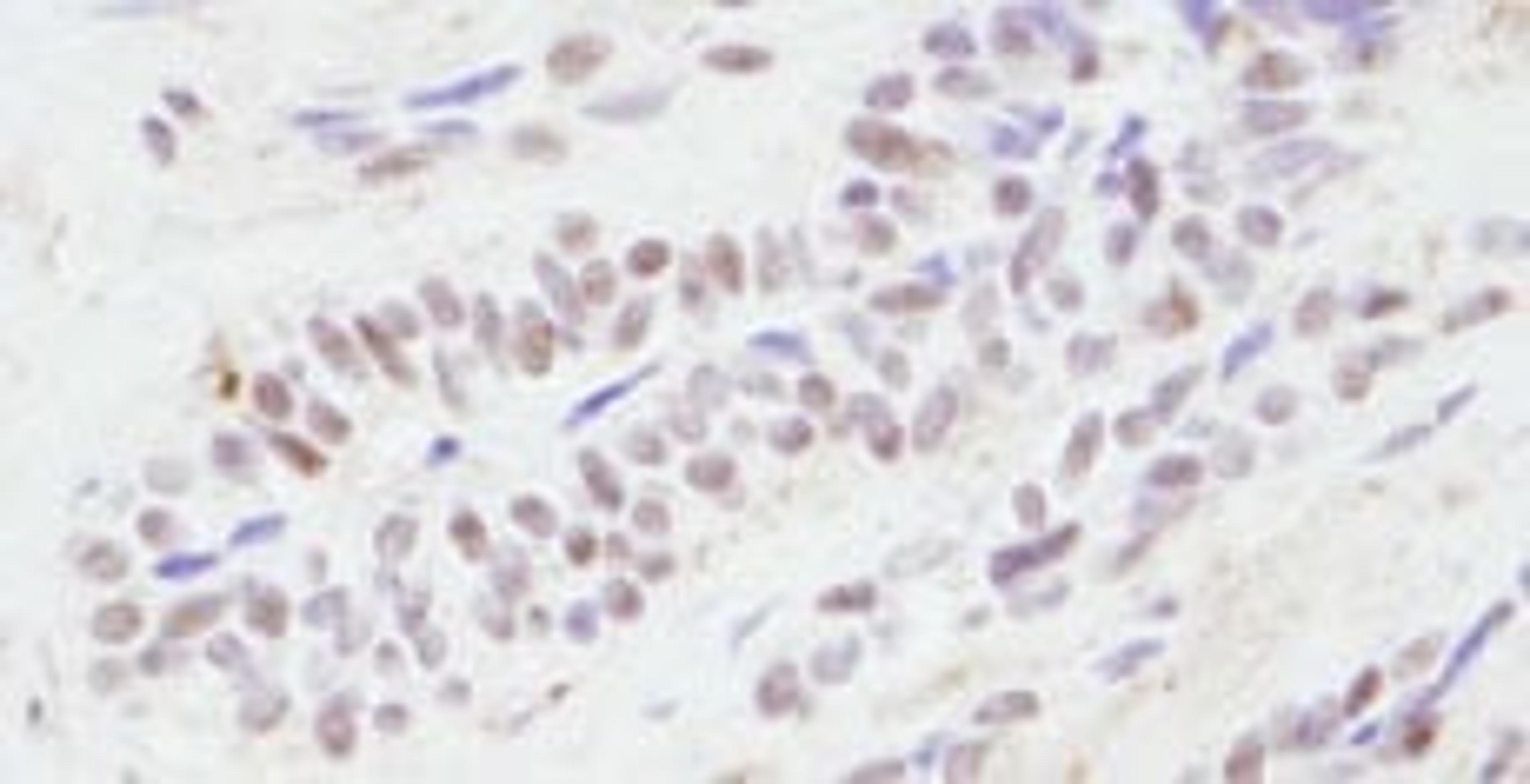 Detection of human CBP by immunohistochemistry.