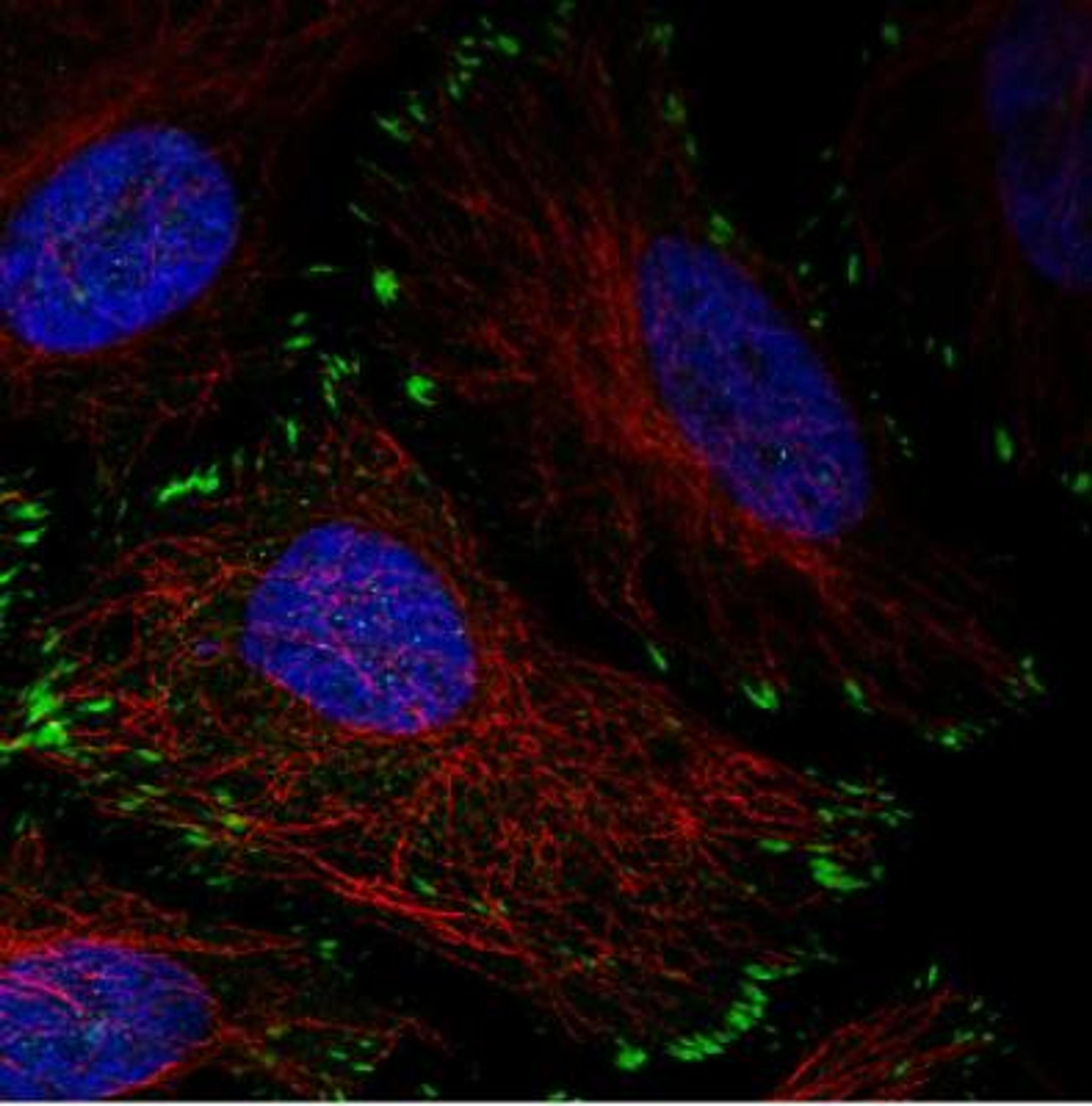 Immunocytochemistry/Immunofluorescence: Zyxin Antibody (CL2502) [NBP2-36768] - Staining in HeLa cell line with Anti-ZYX monoclonal antibody, showing distinct focal adhesion staining in green. Microtubule- and nuclear probes are visualized in red and blue respectively (where available). Antibody staining is shown in green.