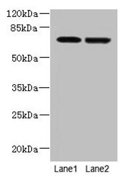 Western blot. All lanes: NETO2 antibody at 4µg/ml. Lane 1: U251 whole cell lysate. Lane 2: MDA-MB-231 whole cell lysate. Secondary. Goat polyclonal to rabbit IgG at 1/10000 dilution. Predicted band size: 60, 23, 59 kDa. Observed band size: 70 kDa