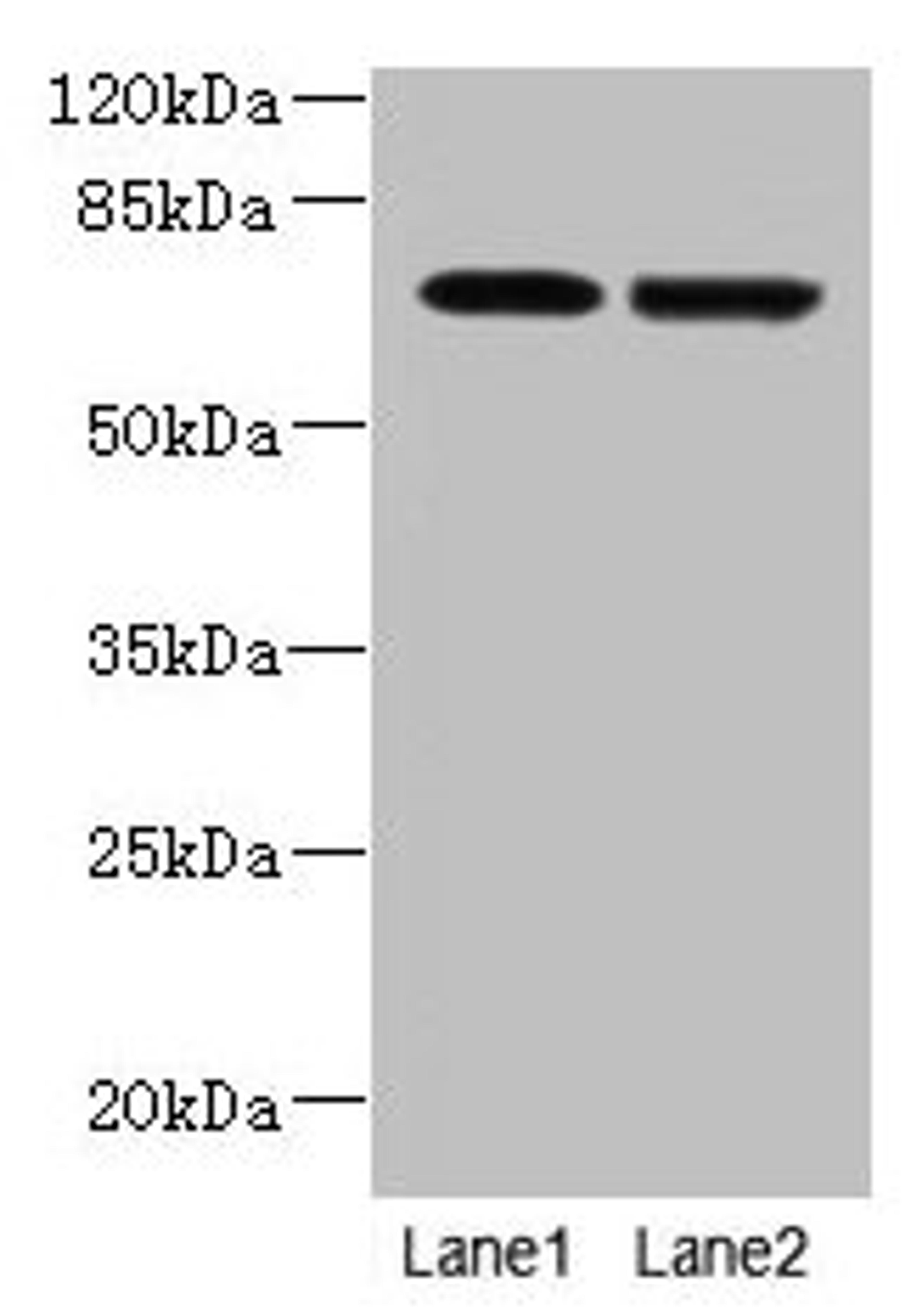 Western blot. All lanes: NETO2 antibody at 4µg/ml. Lane 1: U251 whole cell lysate. Lane 2: MDA-MB-231 whole cell lysate. Secondary. Goat polyclonal to rabbit IgG at 1/10000 dilution. Predicted band size: 60, 23, 59 kDa. Observed band size: 70 kDa