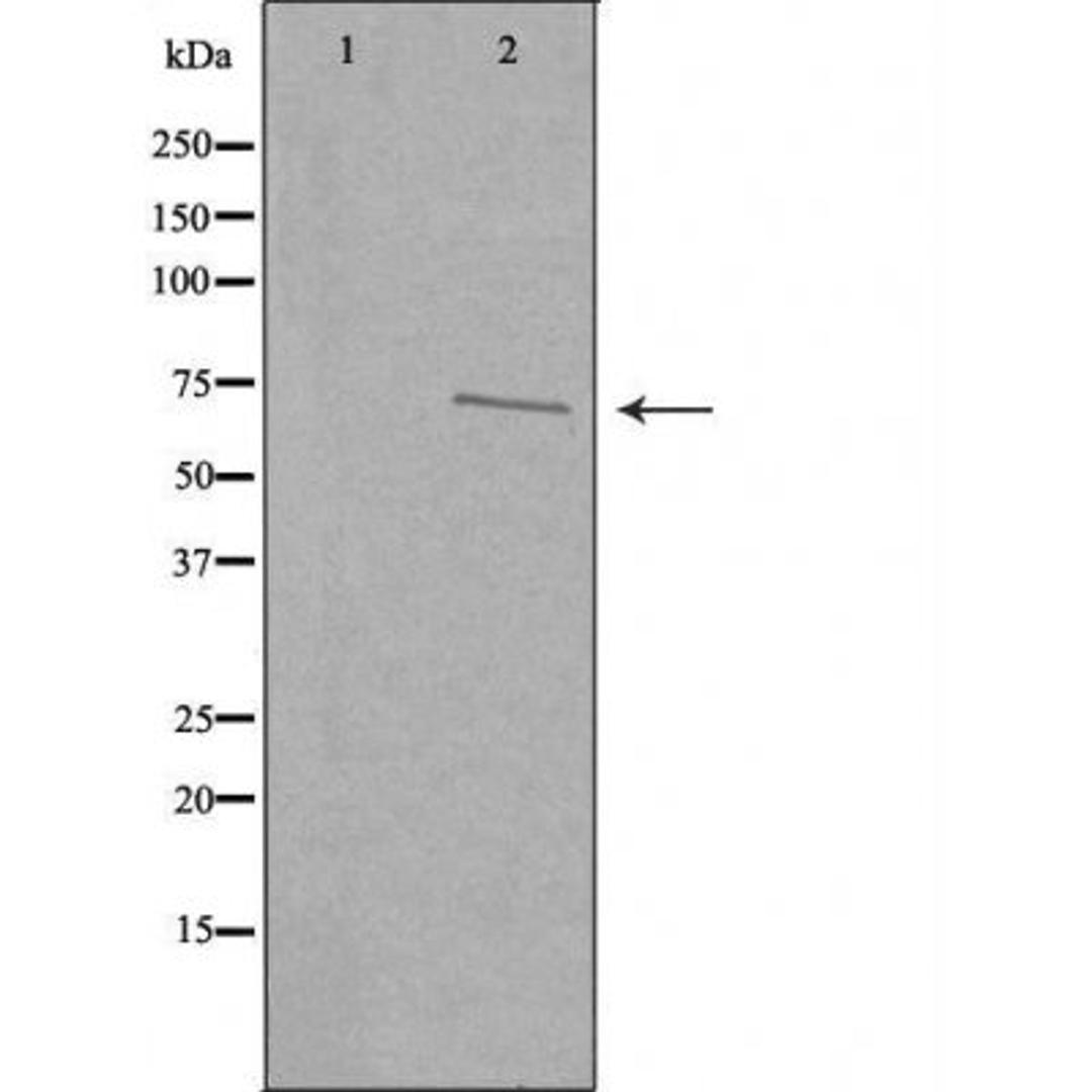 Western blot analysis of COLO205 cells using CDKAL antibody