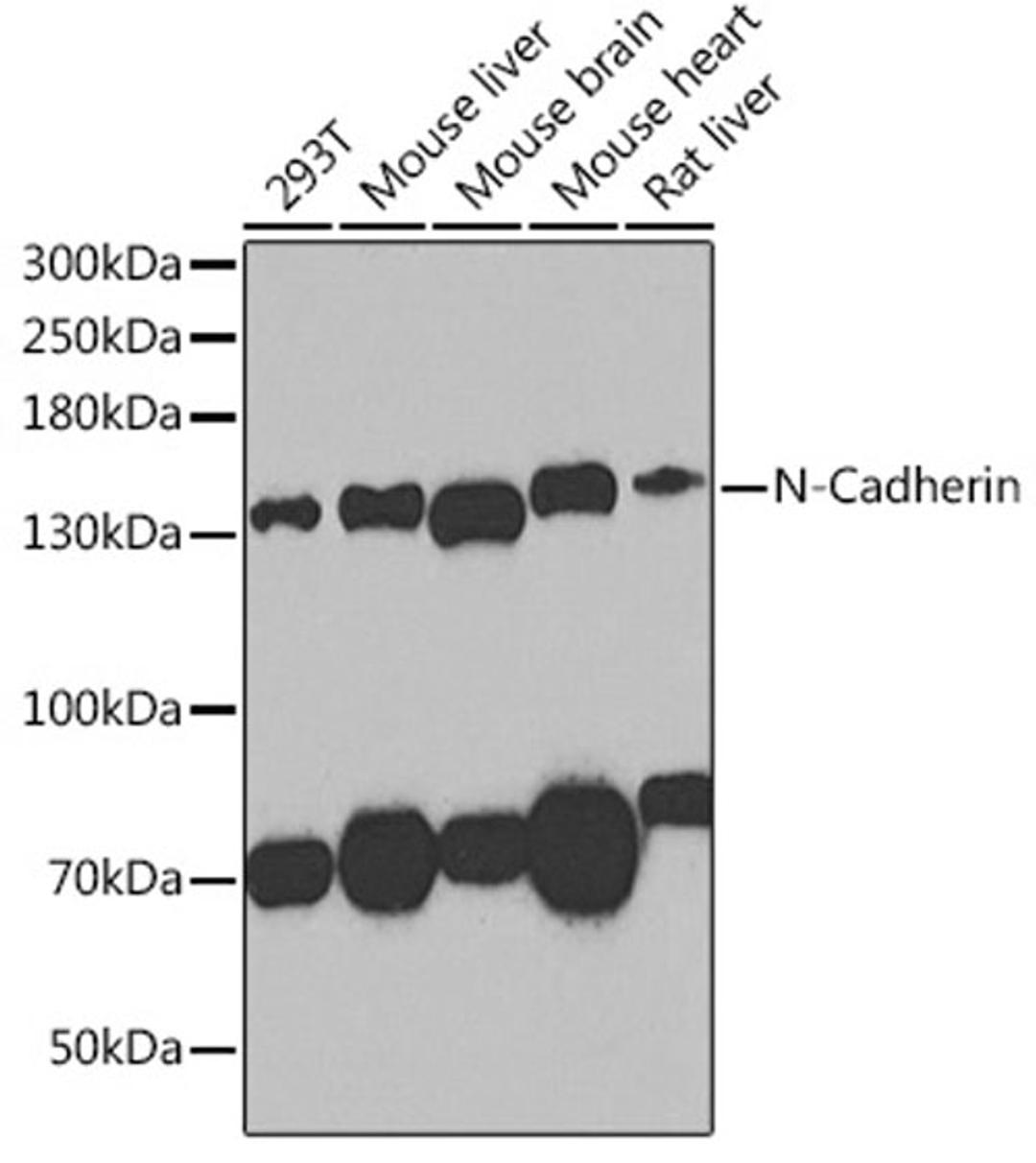 Western blot - N-Cadherin antibody (A0433)