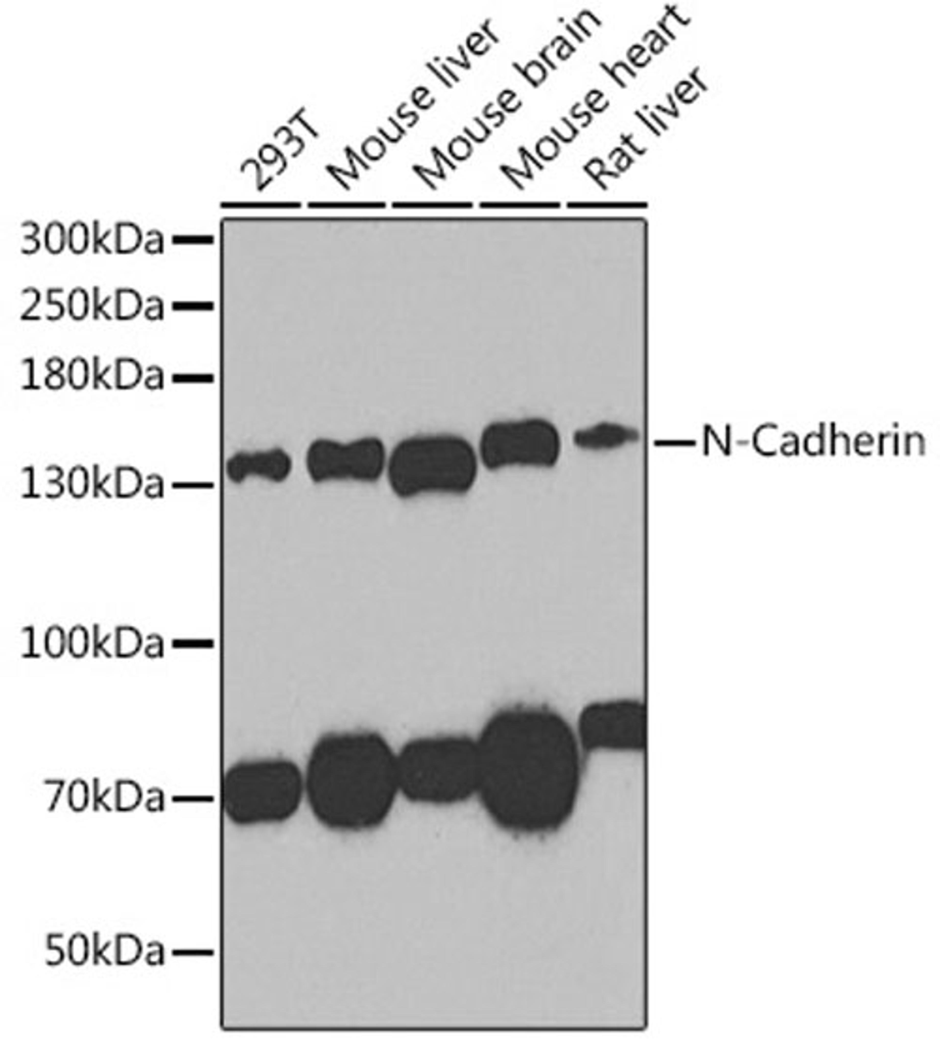 Western blot - N-Cadherin antibody (A0433)