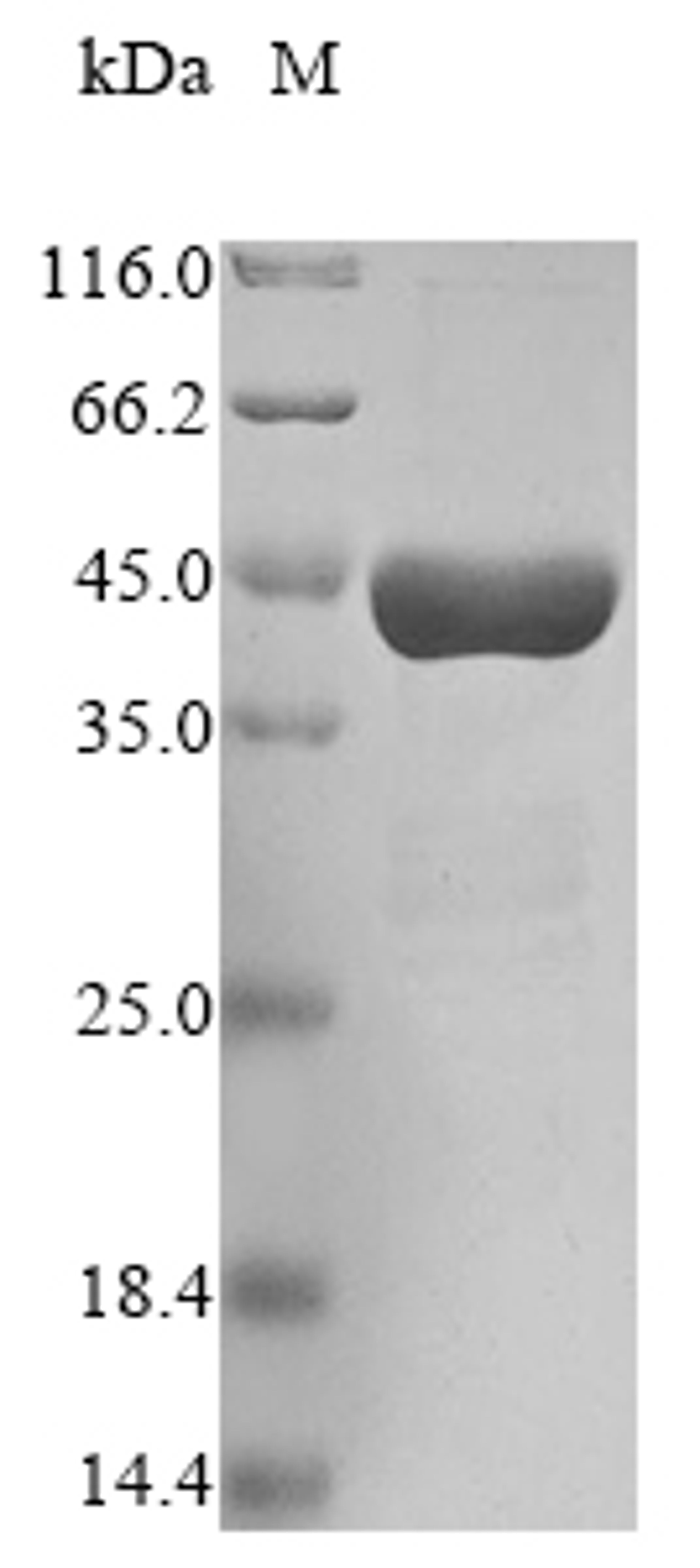 (Tris-Glycine gel) Discontinuous SDS-PAGE (reduced) with 5% enrichment gel and 15% separation gel.