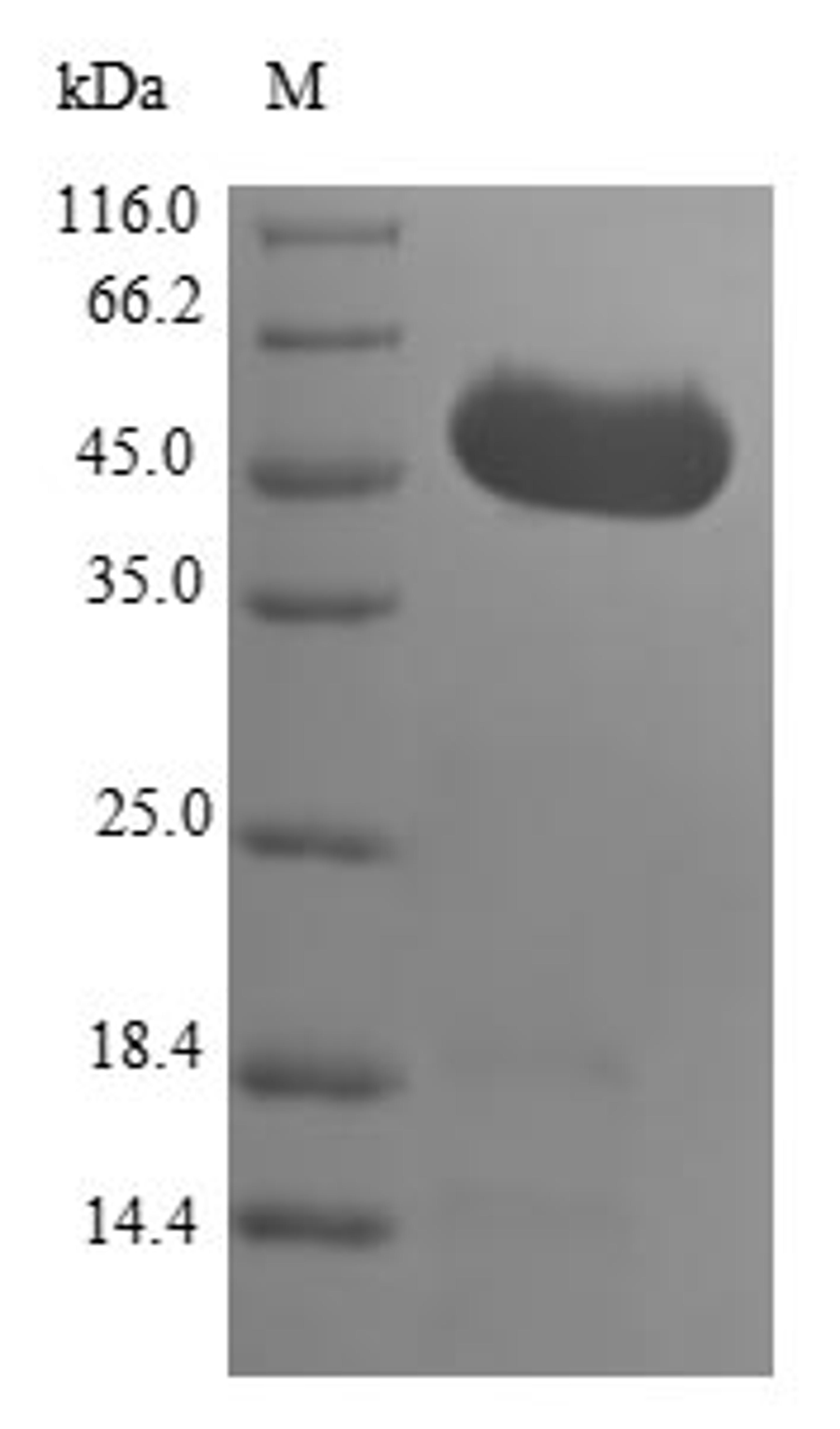 (Tris-Glycine gel) Discontinuous SDS-PAGE (reduced) with 5% enrichment gel and 15% separation gel.