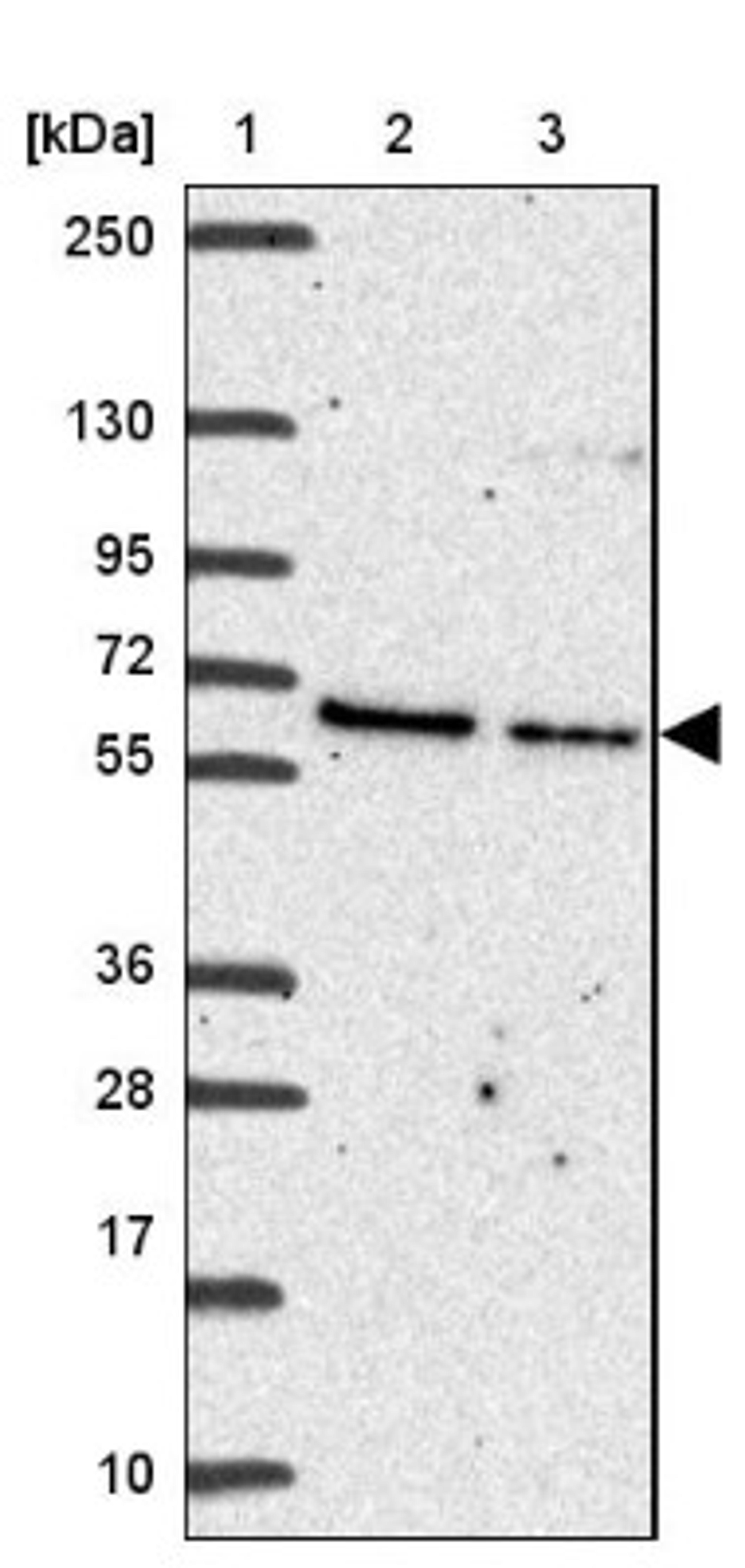 Western Blot: Advillin Antibody [NBP2-34118] - Lane 1: Marker [kDa] 250, 130, 95, 72, 55, 36, 28, 17, 10<br/>Lane 2: Human cell line RT-4<br/>Lane 3: Human cell line U-251MG sp