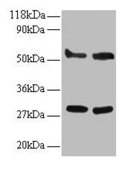 Western blot. All lanes: ERP29 antibody at 2µg/ml. Lane 1: EC109 whole cell lysate. Lane 2: 293T whole cell lysate. Secondary. Goat polyclonal to rabbit IgG at 1/15000 dilution. Predicted band size: 29, 6 kDa. Observed band size: 29, 55 kDa