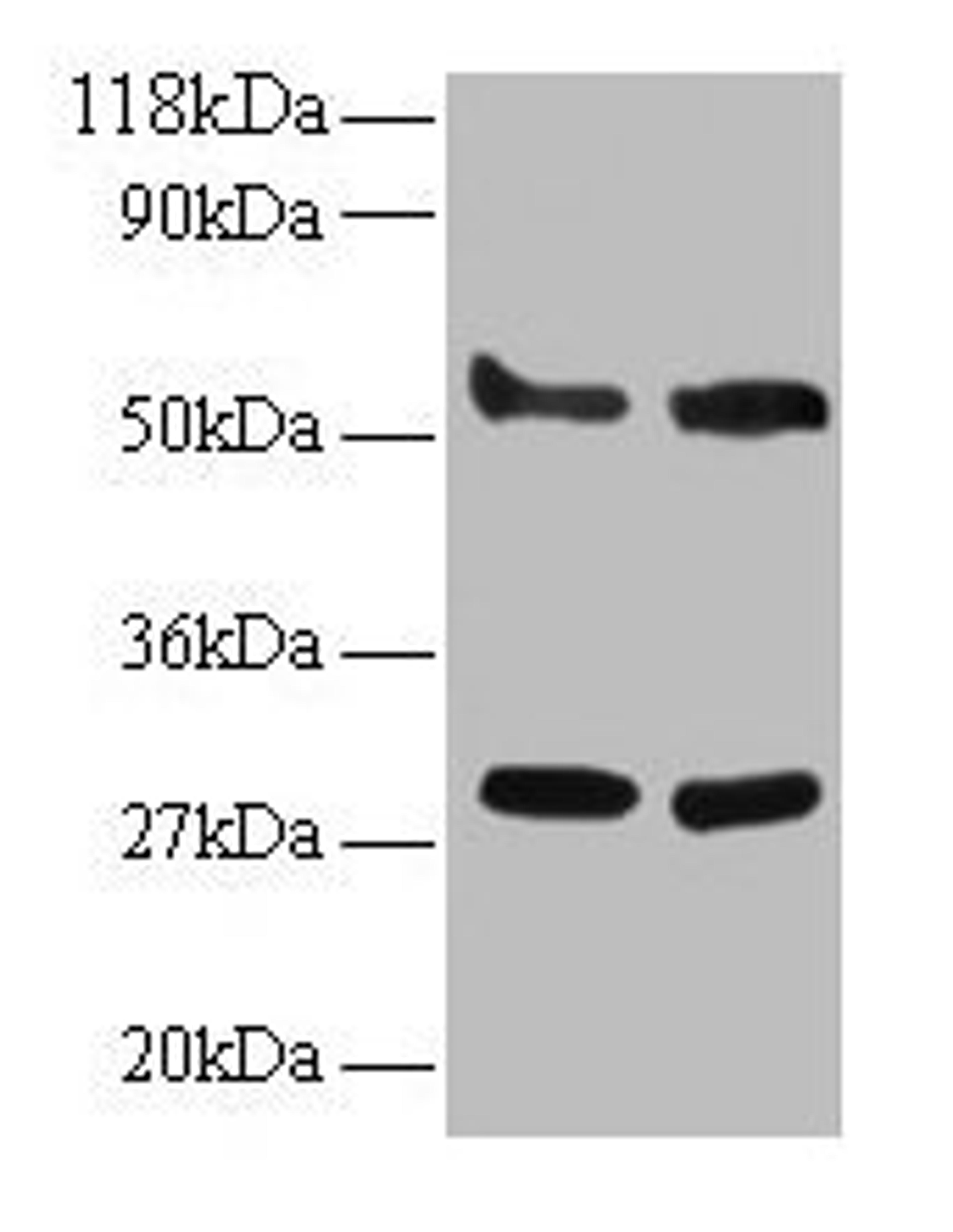 Western blot. All lanes: ERP29 antibody at 2µg/ml. Lane 1: EC109 whole cell lysate. Lane 2: 293T whole cell lysate. Secondary. Goat polyclonal to rabbit IgG at 1/15000 dilution. Predicted band size: 29, 6 kDa. Observed band size: 29, 55 kDa