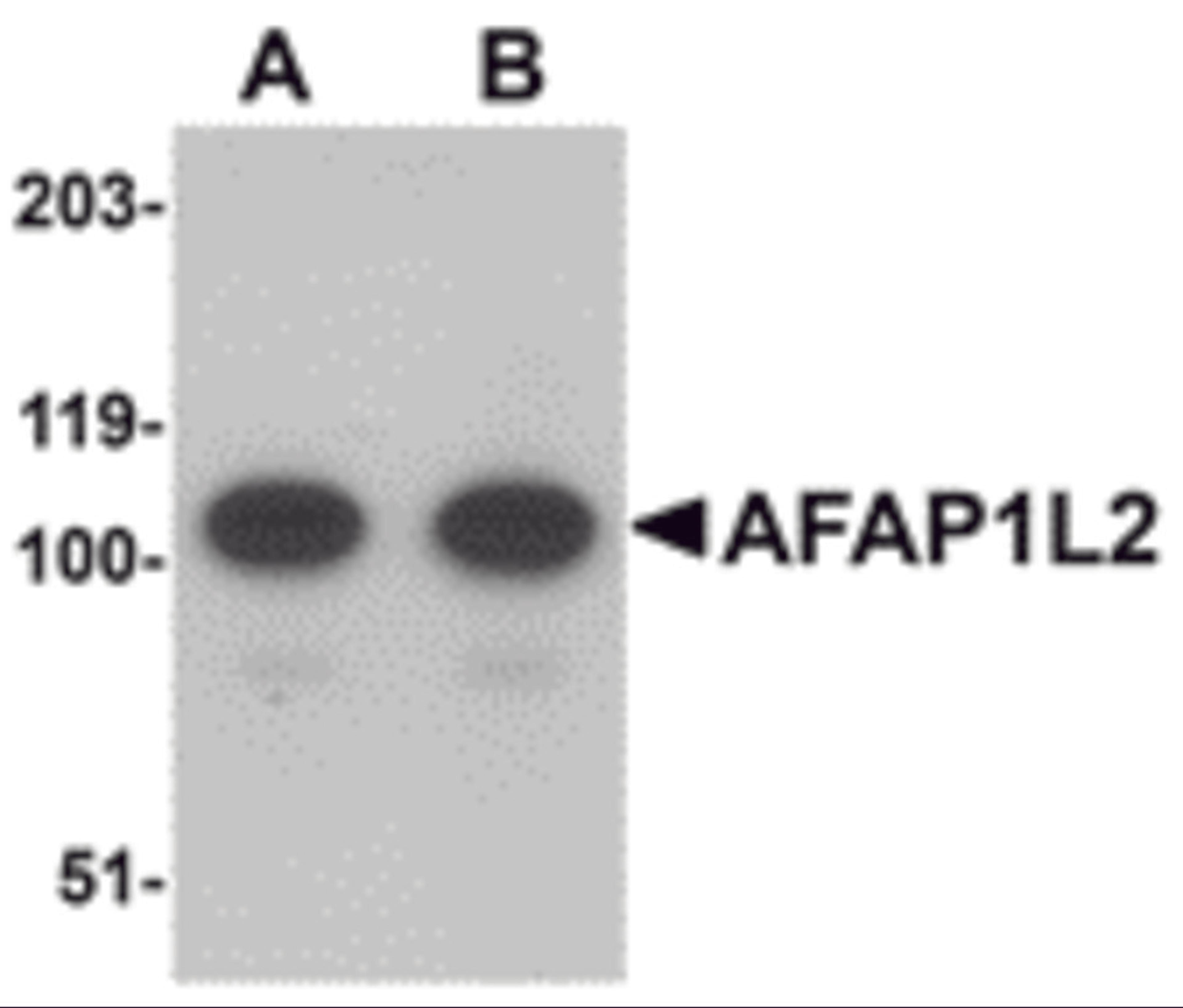 Western blot analysis of AFAP1L2 in mouse liver tissue lysate with AFAP1L2 antibody at (A) 1 and (B) 2 &#956;g/mL.