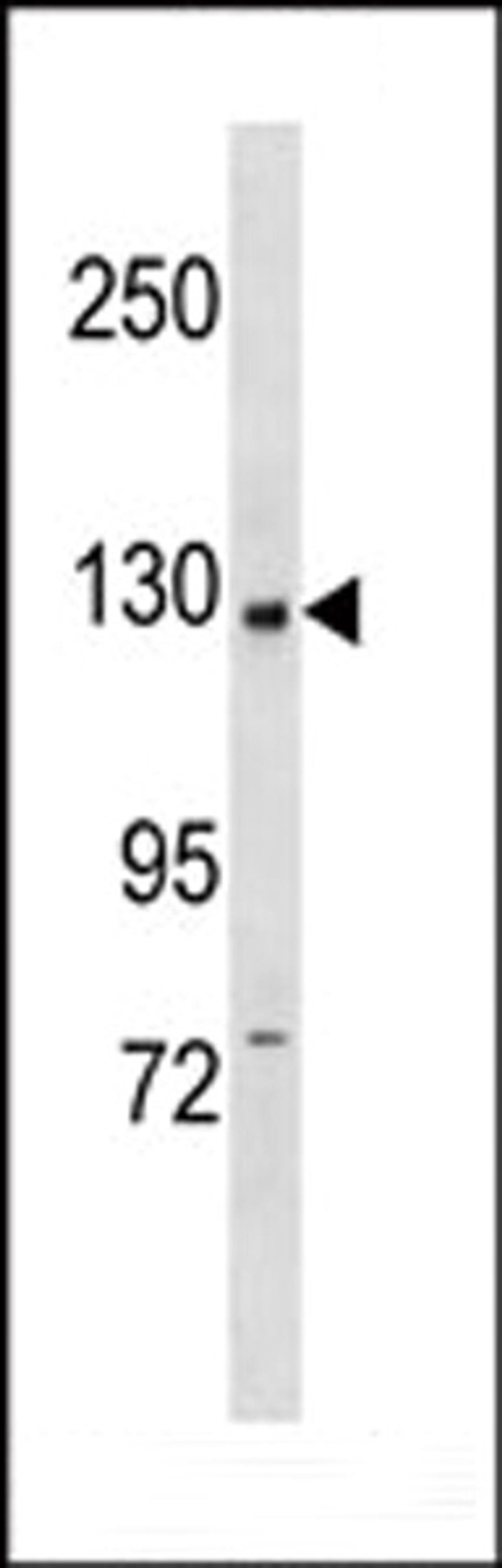 Western blot analysis in CEM cell line lysates (35ug/lane).This demonstrates the PI3KCB antibody detected the PI3KCB protein (arrow).