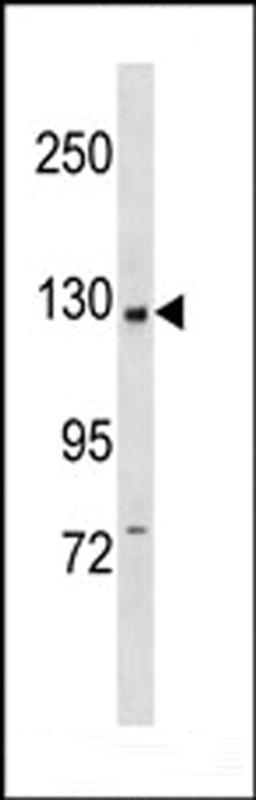 Western blot analysis in CEM cell line lysates (35ug/lane).This demonstrates the PI3KCB antibody detected the PI3KCB protein (arrow).