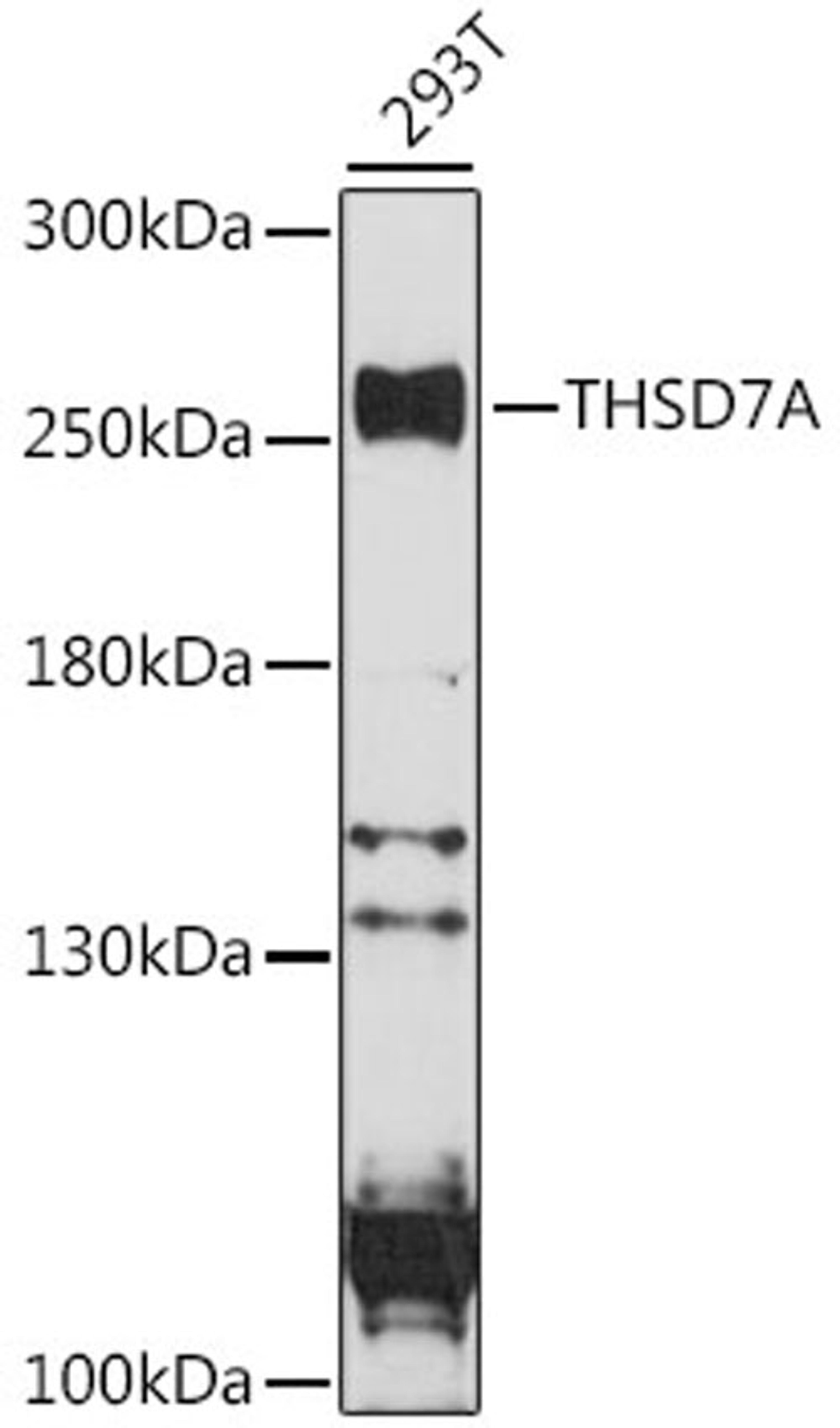 Western blot - THSD7A antibody (A16610)