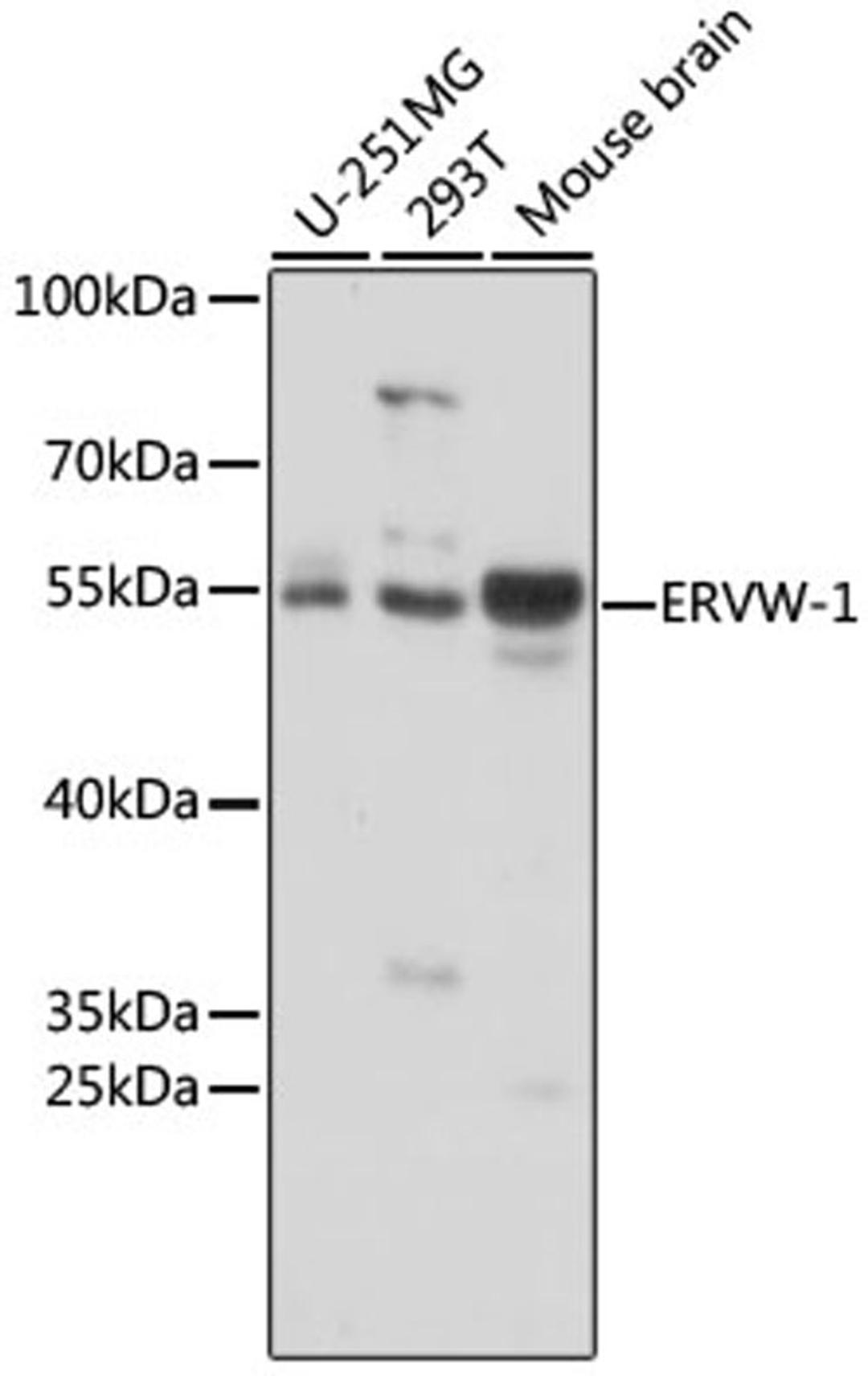 Western blot - ERVW-1 antibody (A16522)