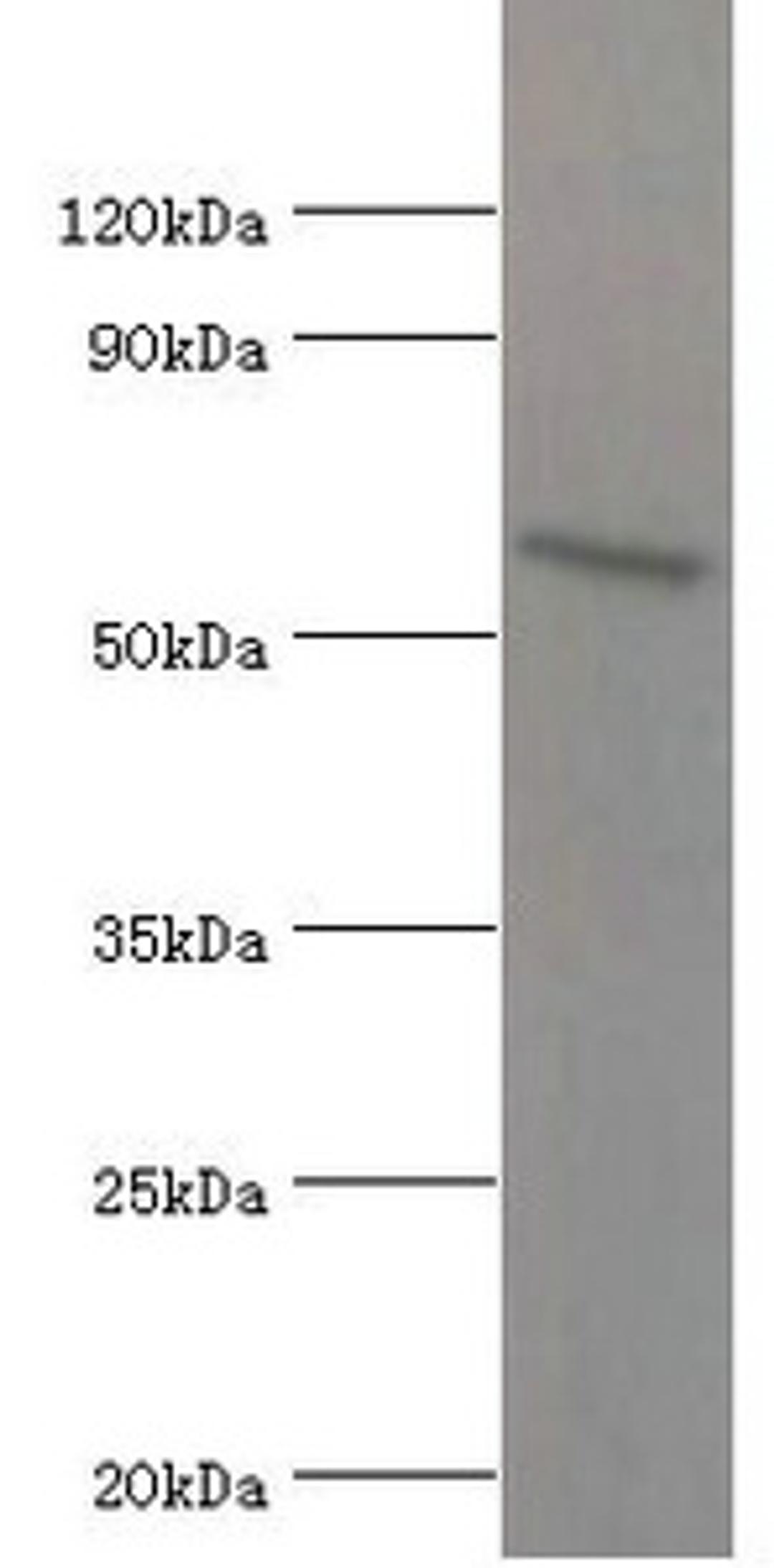 Western blot. All lanes: ATG16L1 antibody at 2µg/ml + MCF-7 whole cell lysate. Secondary. Goat polyclonal to rabbit IgG at 1/10000 dilution. Predicted band size: 69, 67, 54, 48, 50 kDa. Observed band size: 69 kDa
