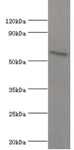 Western blot. All lanes: ATG16L1 antibody at 2µg/ml + MCF-7 whole cell lysate. Secondary. Goat polyclonal to rabbit IgG at 1/10000 dilution. Predicted band size: 69, 67, 54, 48, 50 kDa. Observed band size: 69 kDa
