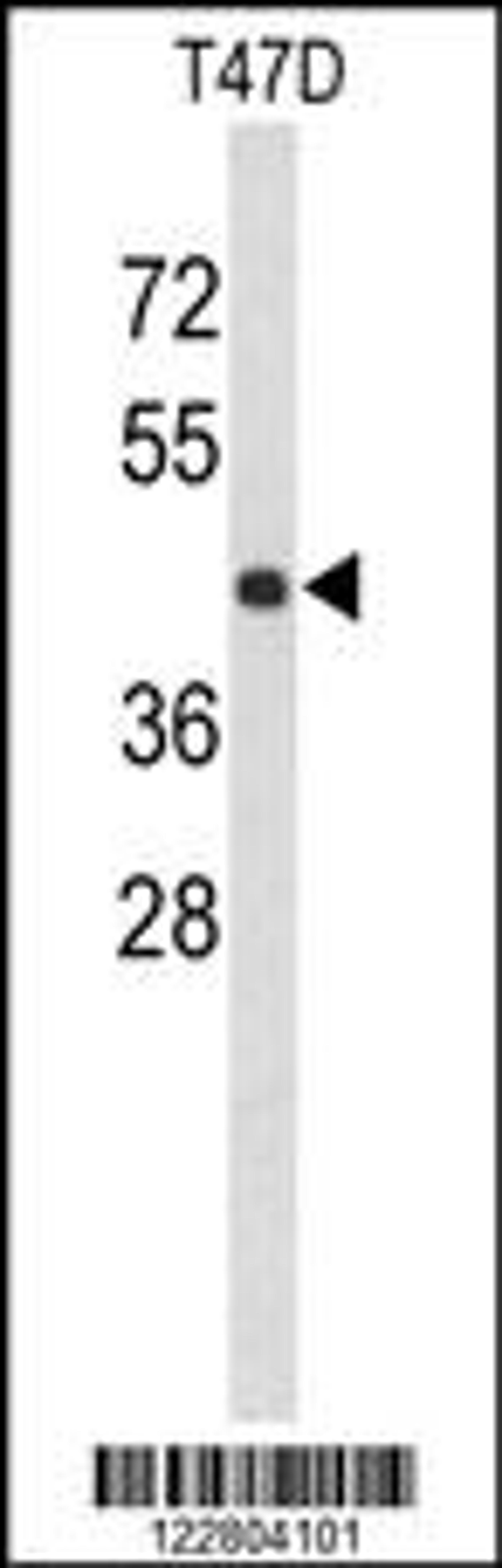 Western blot analysis of KCTD12 Antibody in T47D cell line lysates (35ug/lane)