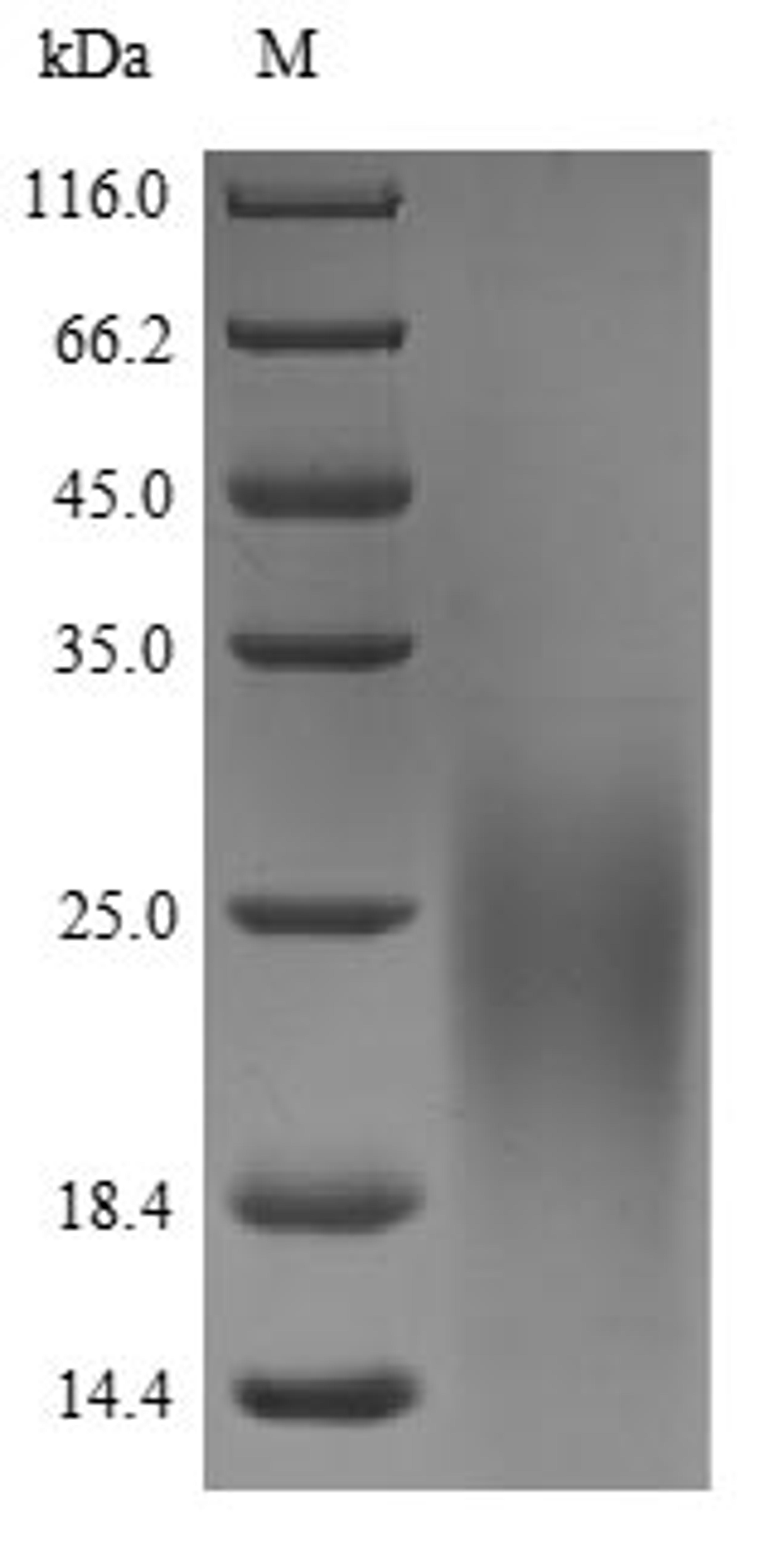 (Tris-Glycine gel) Discontinuous SDS-PAGE (reduced) with 5% enrichment gel and 15% separation gel.