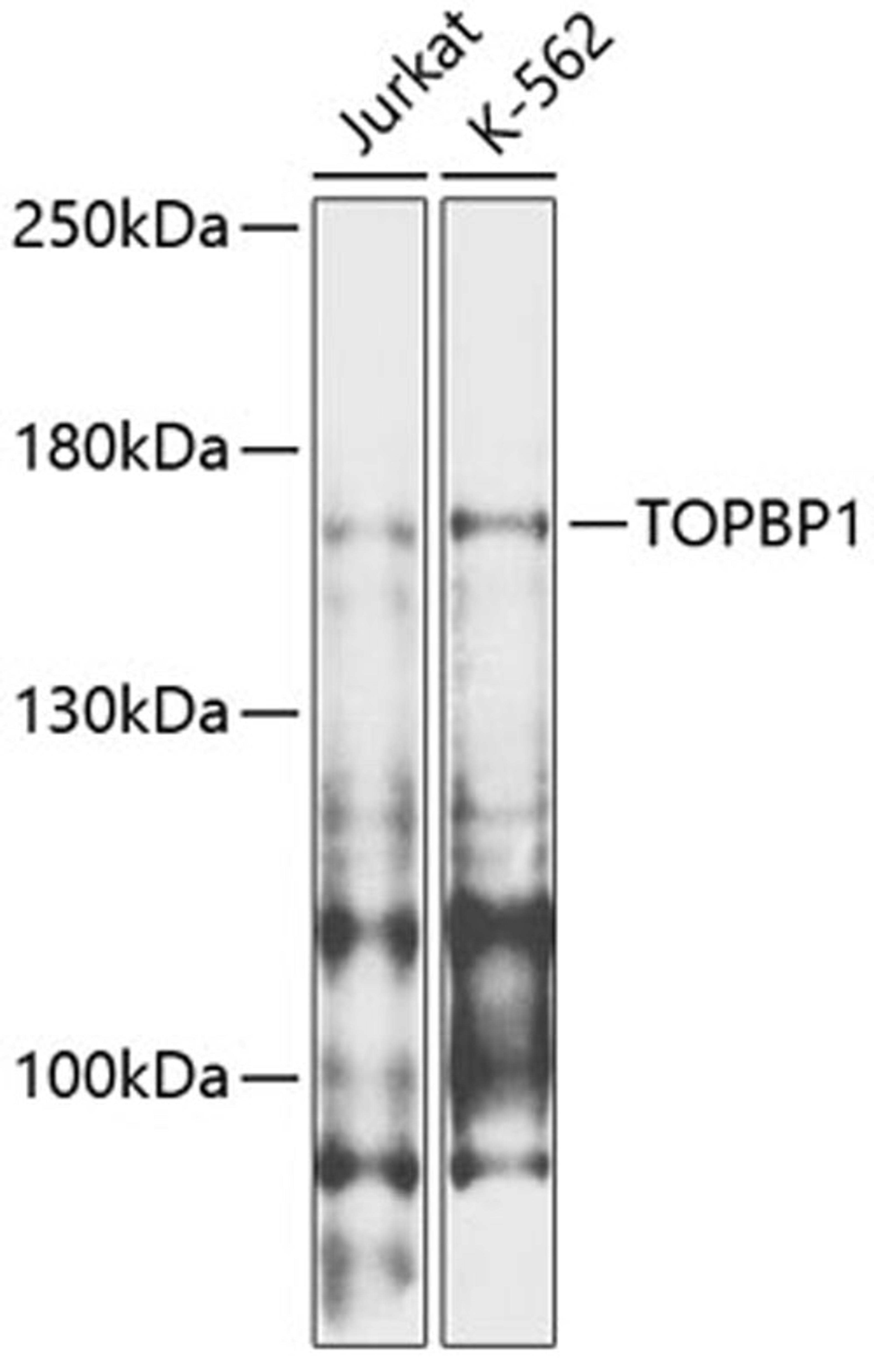 Western blot - TOPBP1 antibody (A12574)