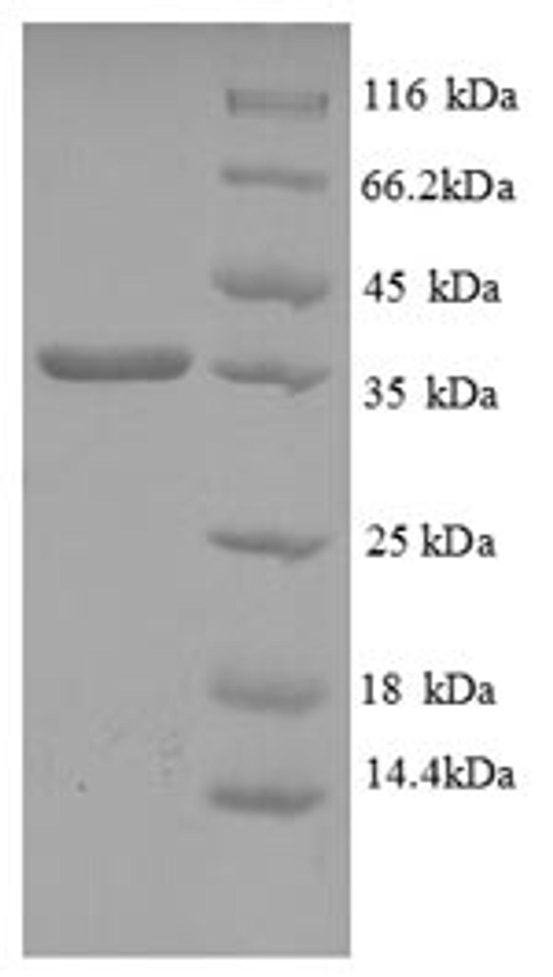 (Tris-Glycine gel) Discontinuous SDS-PAGE (reduced) with 5% enrichment gel and 15% separation gel.