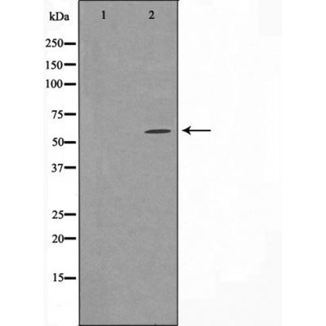 Western blot analysis of HUVEC cells using 24A1 (Cytochrome P450) antibody