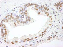 Detection of human RBM25/RED120 by immunohistochemistry.