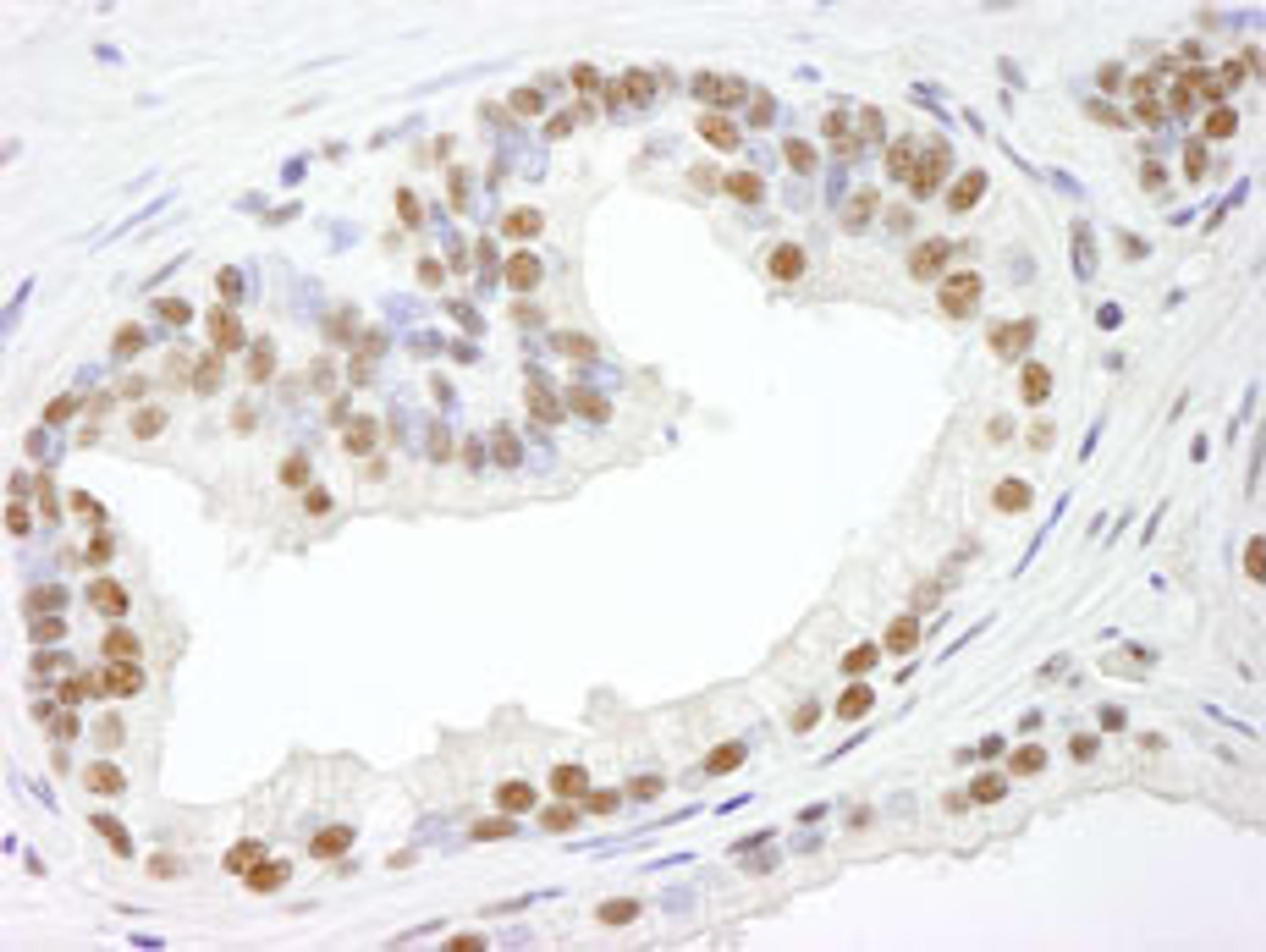 Detection of human RBM25/RED120 by immunohistochemistry.