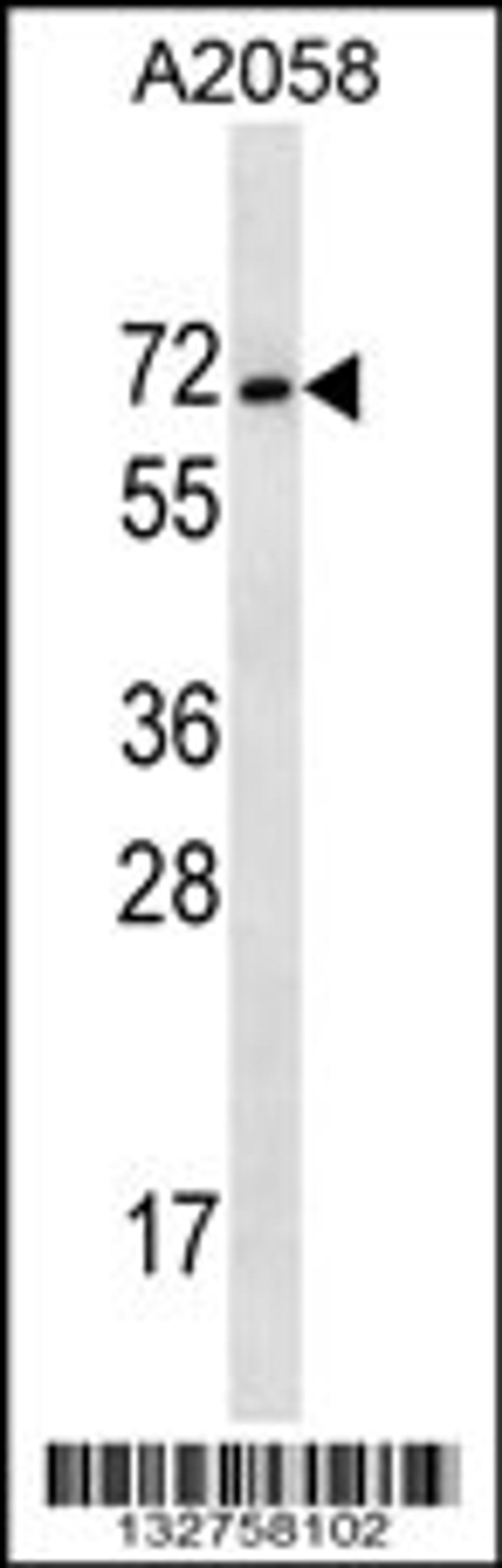 Western blot analysis in A2058 cell line lysates (35ug/lane).