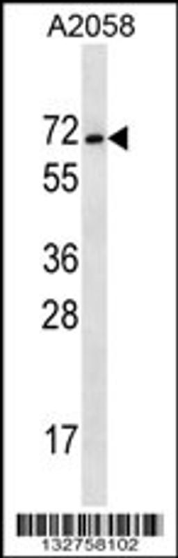 Western blot analysis in A2058 cell line lysates (35ug/lane).