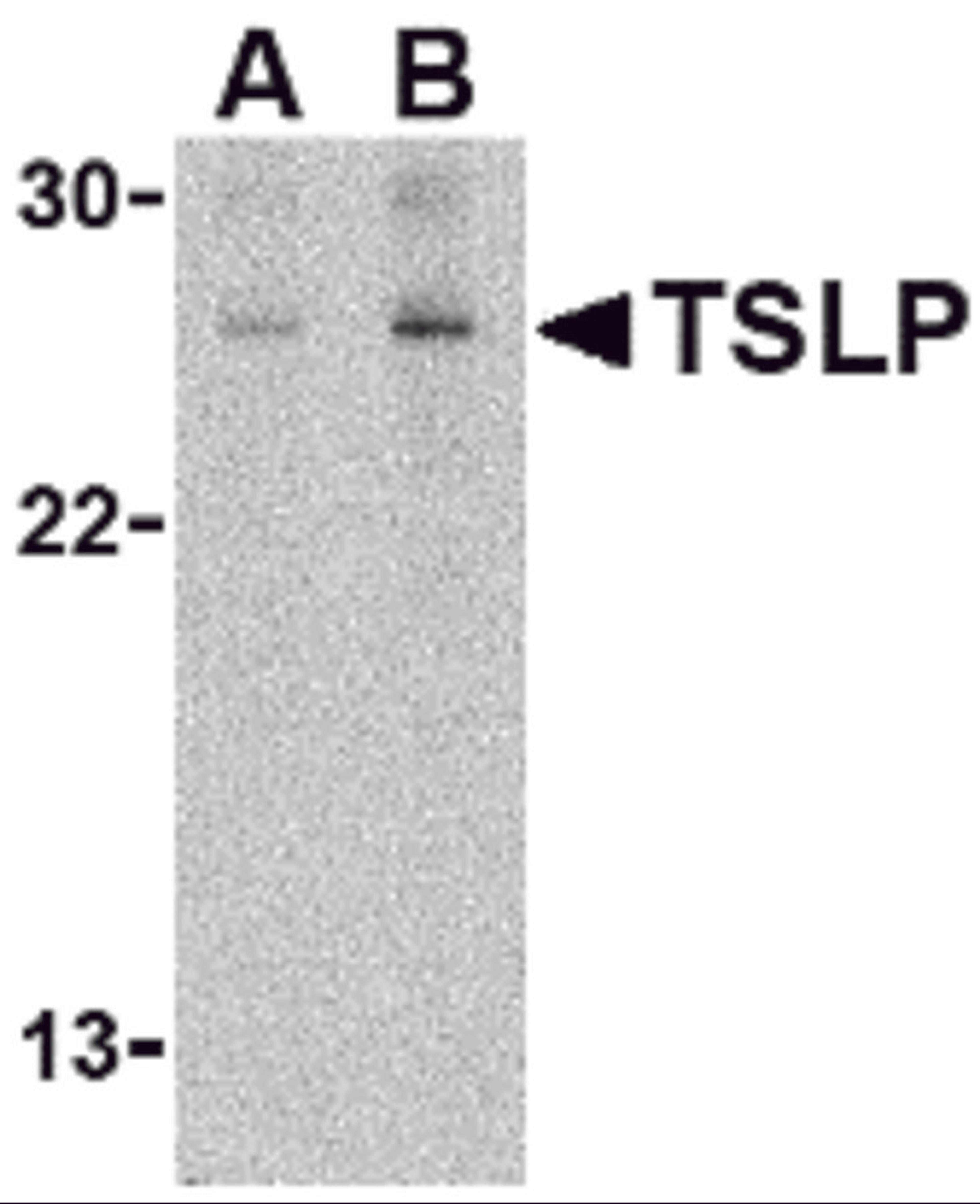 Western blot analysis of TSLP in Jurkat cell lysate with TSLP antibody at (A) 1 and (B) 2 &#956;g/mL. 