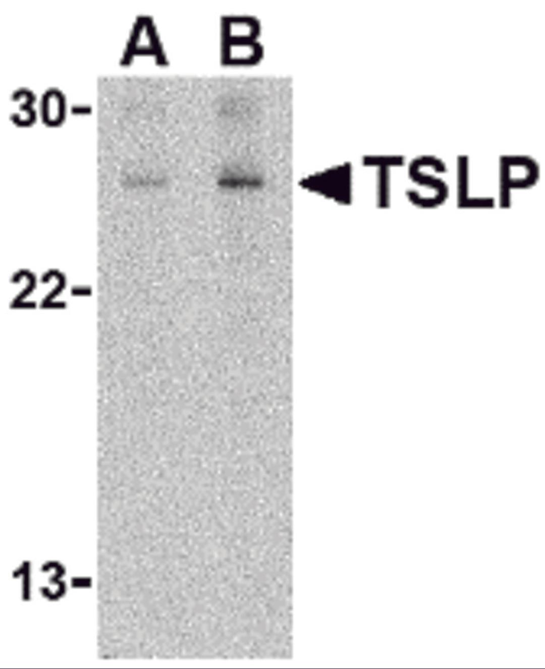 Western blot analysis of TSLP in Jurkat cell lysate with TSLP antibody at (A) 1 and (B) 2 μg/mL.