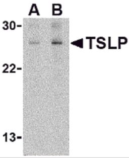 Western blot analysis of TSLP in Jurkat cell lysate with TSLP antibody at (A) 1 and (B) 2 μg/mL.
