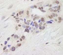 Detection of human STAT6 by immunohistochemistry.