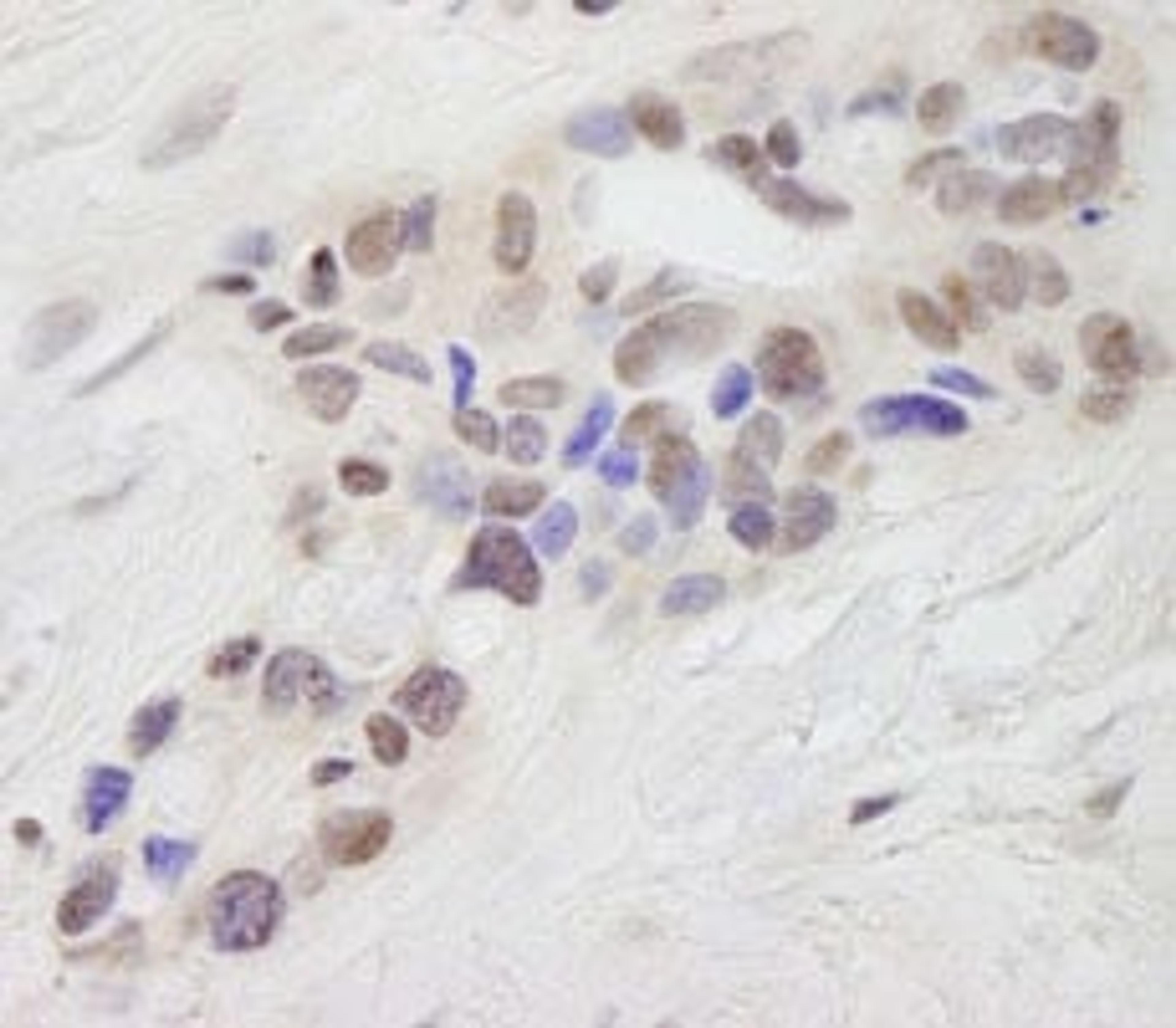 Detection of human STAT6 by immunohistochemistry.