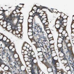 Immunohistochemistry: Urotensin-2 Antibody [NBP1-87223] - Analysis of human small intestine shows distinct cytoplasmic positivity in glandular cells.