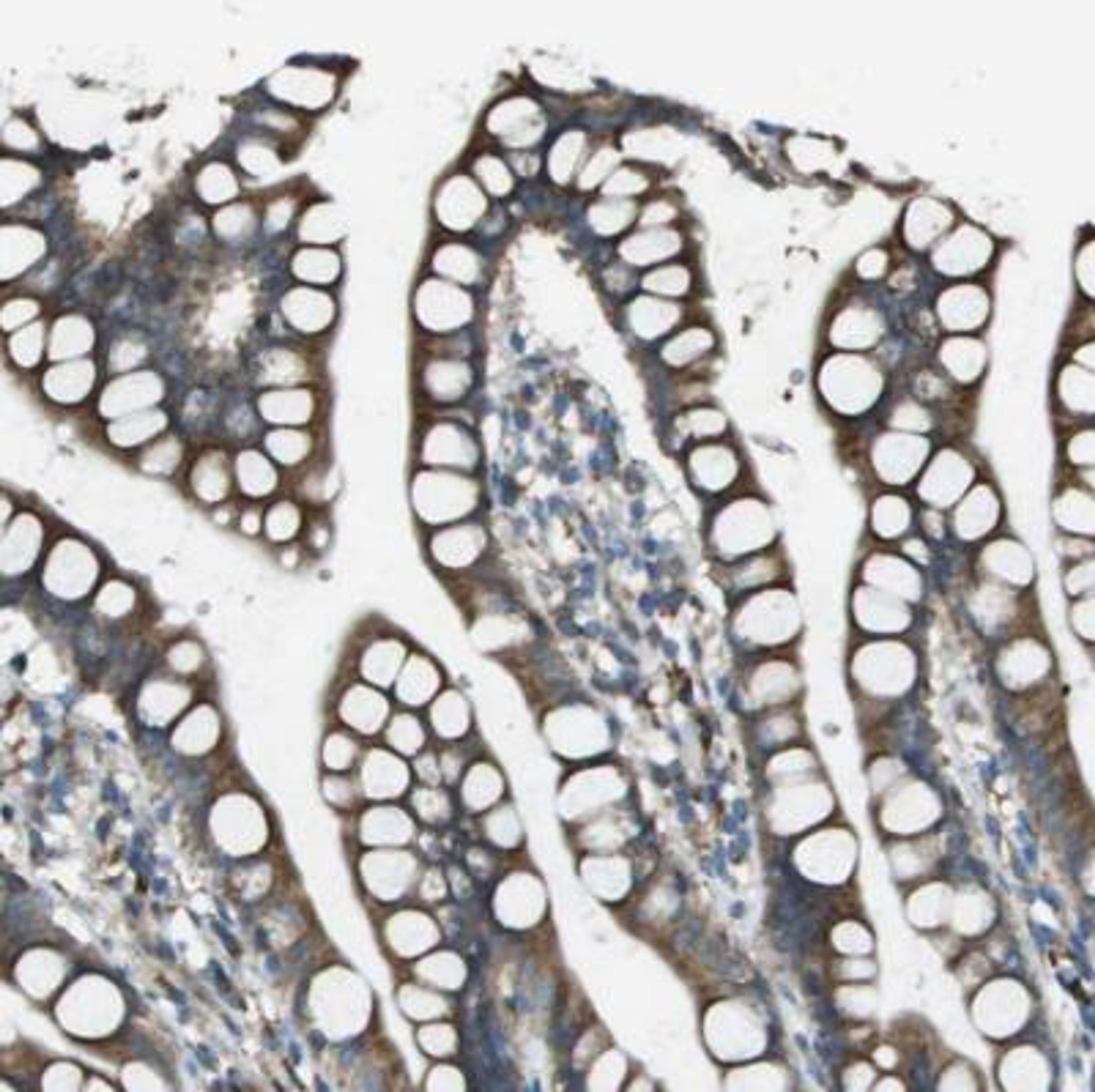 Immunohistochemistry: Urotensin-2 Antibody [NBP1-87223] - Analysis of human small intestine shows distinct cytoplasmic positivity in glandular cells.