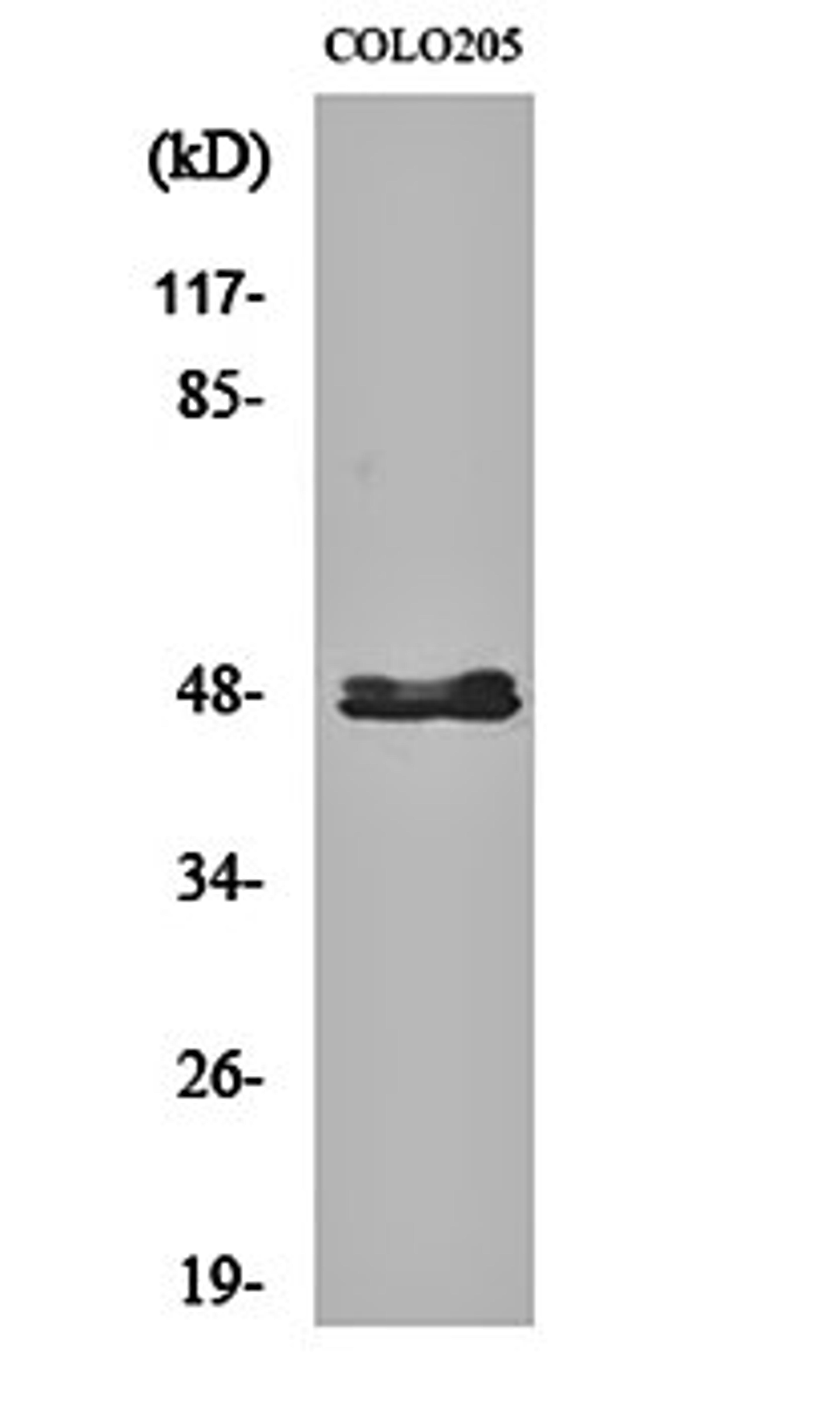 Western blot analysis of COLO205 cell lysates using CYP11B1/2 antibody