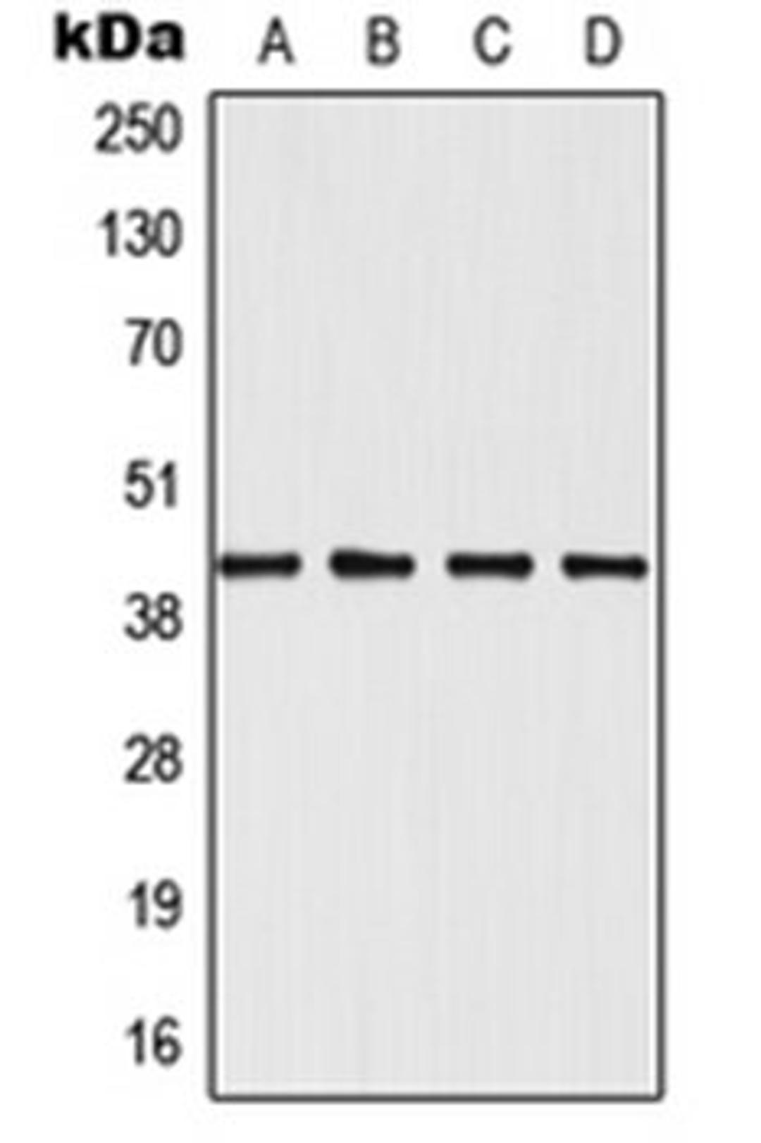 Western blot analysis of Jurkat (Lane 1), HeLa (Lane 2), NIH3T3 (Lane 3), H9C2 (Lane 4) whole cell lysates using MAPK12 antibody