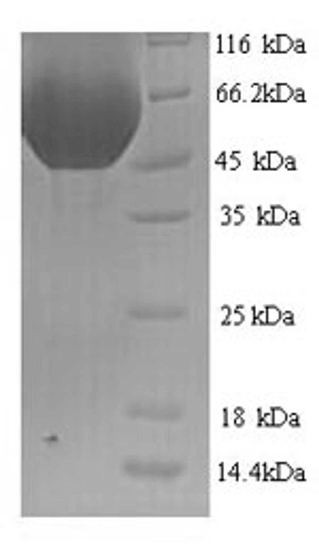 (Tris-Glycine gel) Discontinuous SDS-PAGE (reduced) with 5% enrichment gel and 15% separation gel.
