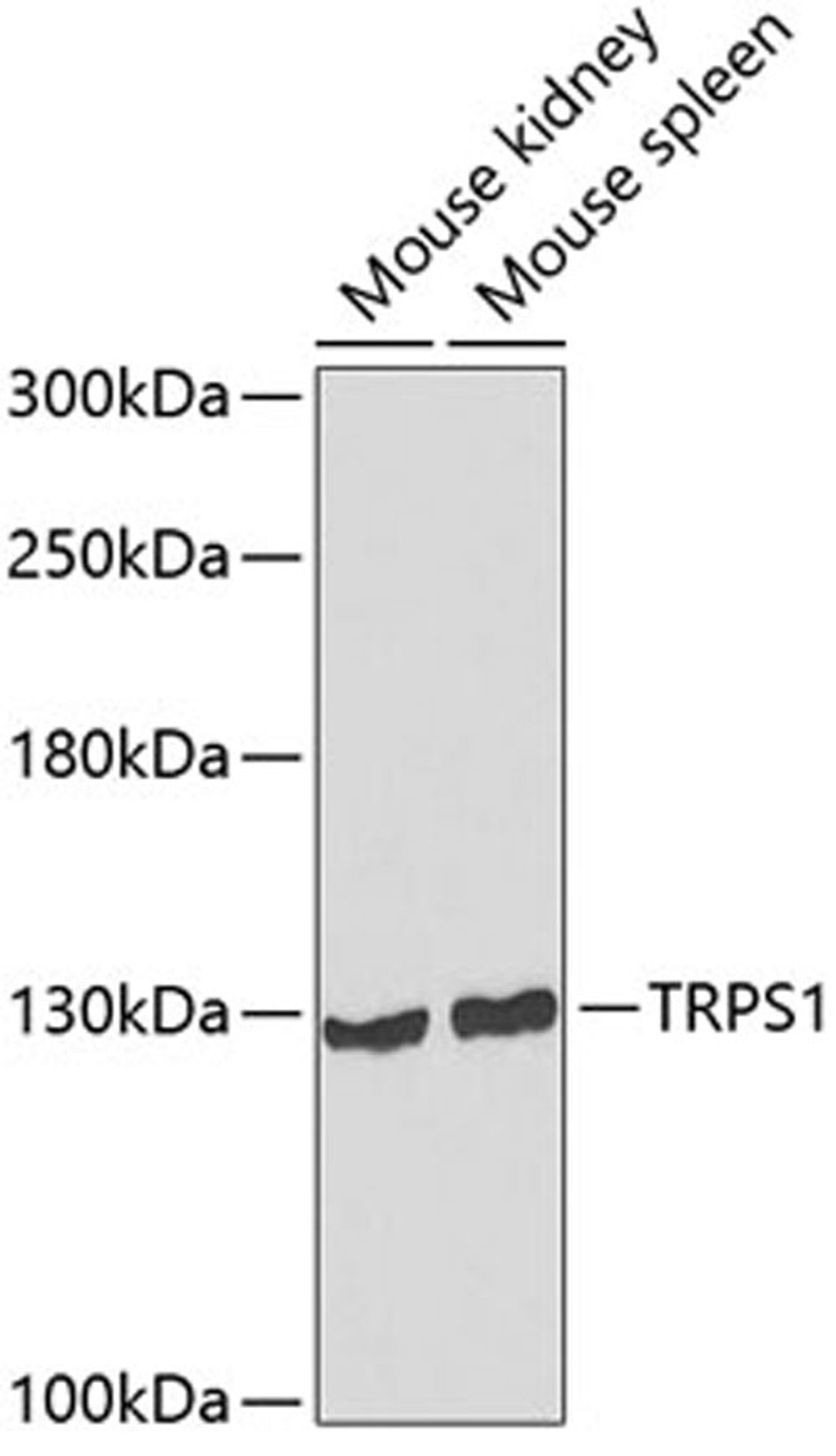 Western blot - TRPS1 antibody (A7743)