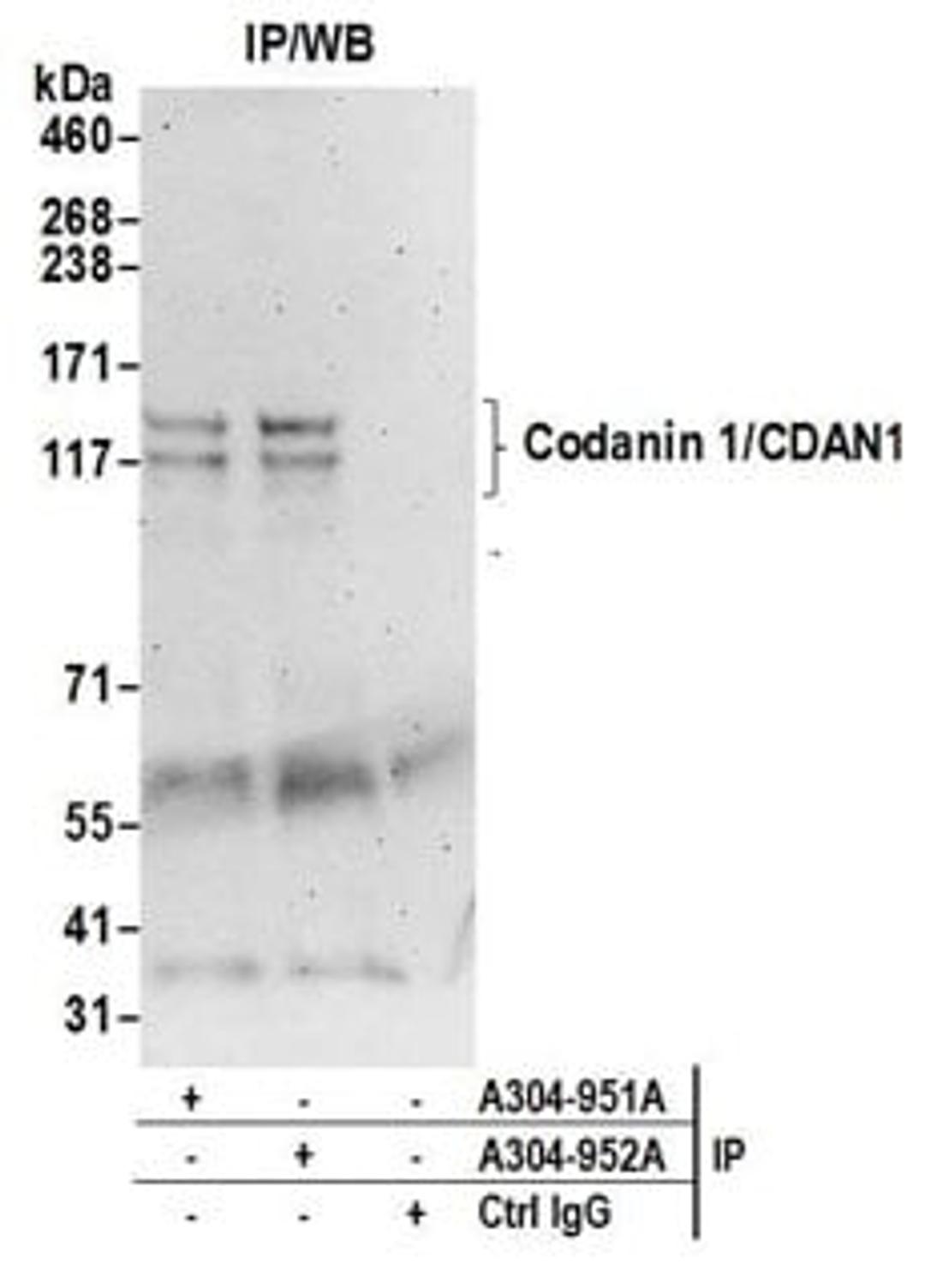 Detection of human Codanin 1/CDAN1 by western blot of immunoprecipitates.