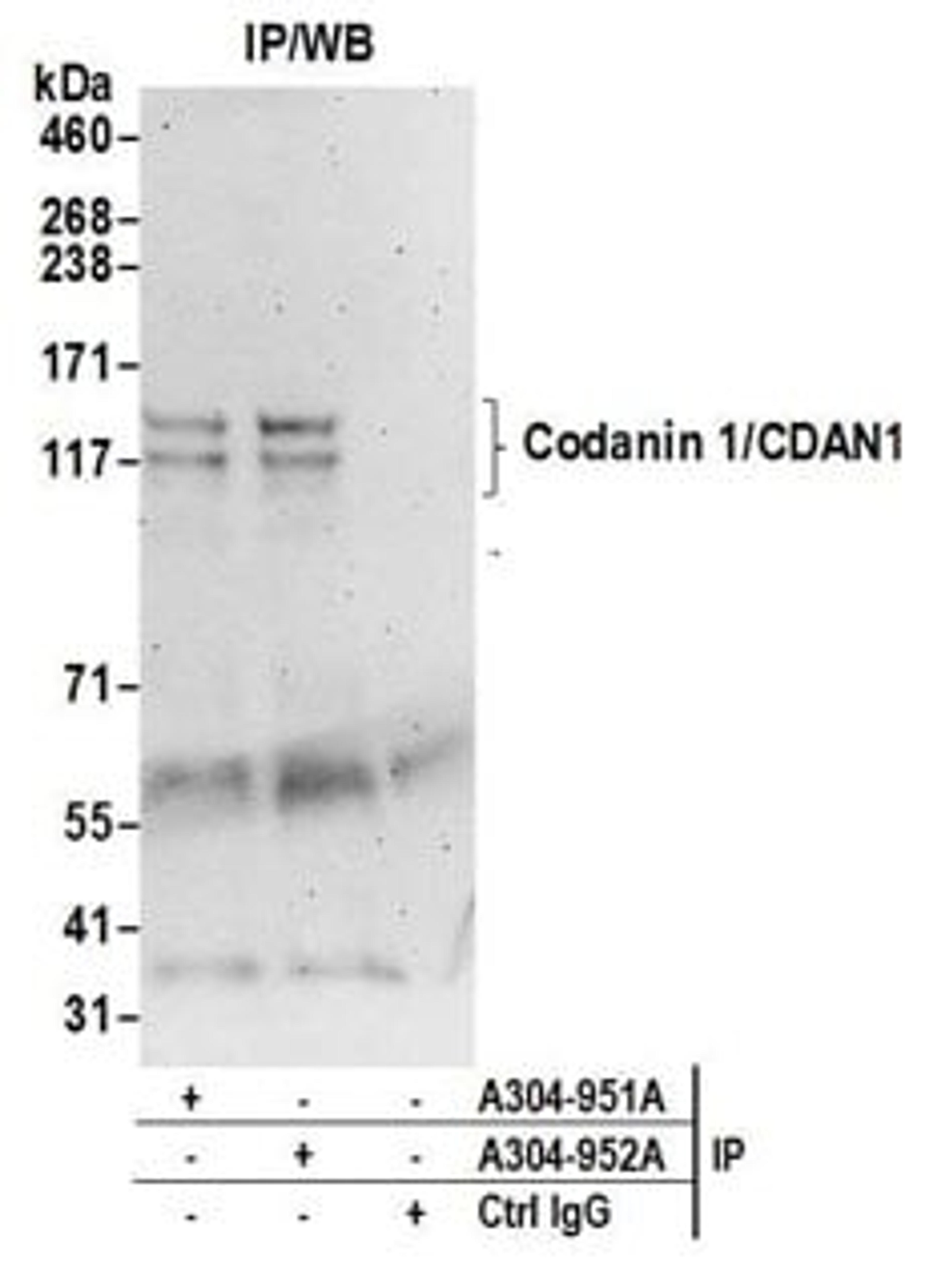 Detection of human Codanin 1/CDAN1 by western blot of immunoprecipitates.