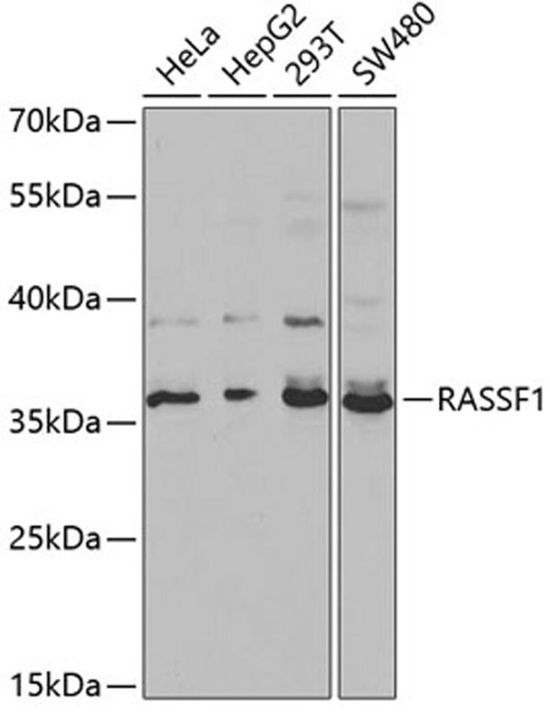 Western blot - RASSF1 antibody (A1203)