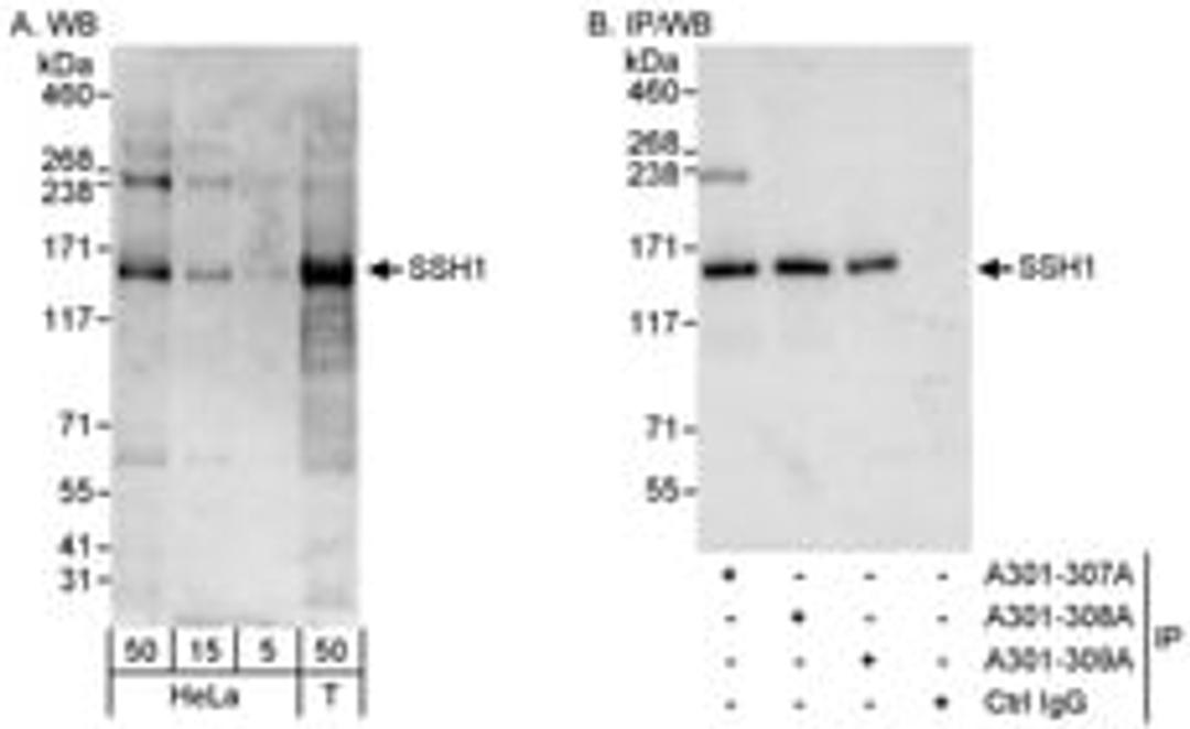 Detection of human SSH1 by western blot and immunoprecipitation.