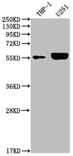 Western Blot. Positive WB detected in: THP-1 whole cell lysate, U251 whole cell lysate. All lanes: IRAK4 antibody at 1:2000. Secondary. Goat polyclonal to rabbit IgG at 1/50000 dilution. Predicted band size: 52, 38 kDa. Observed band size: 55 kDa.