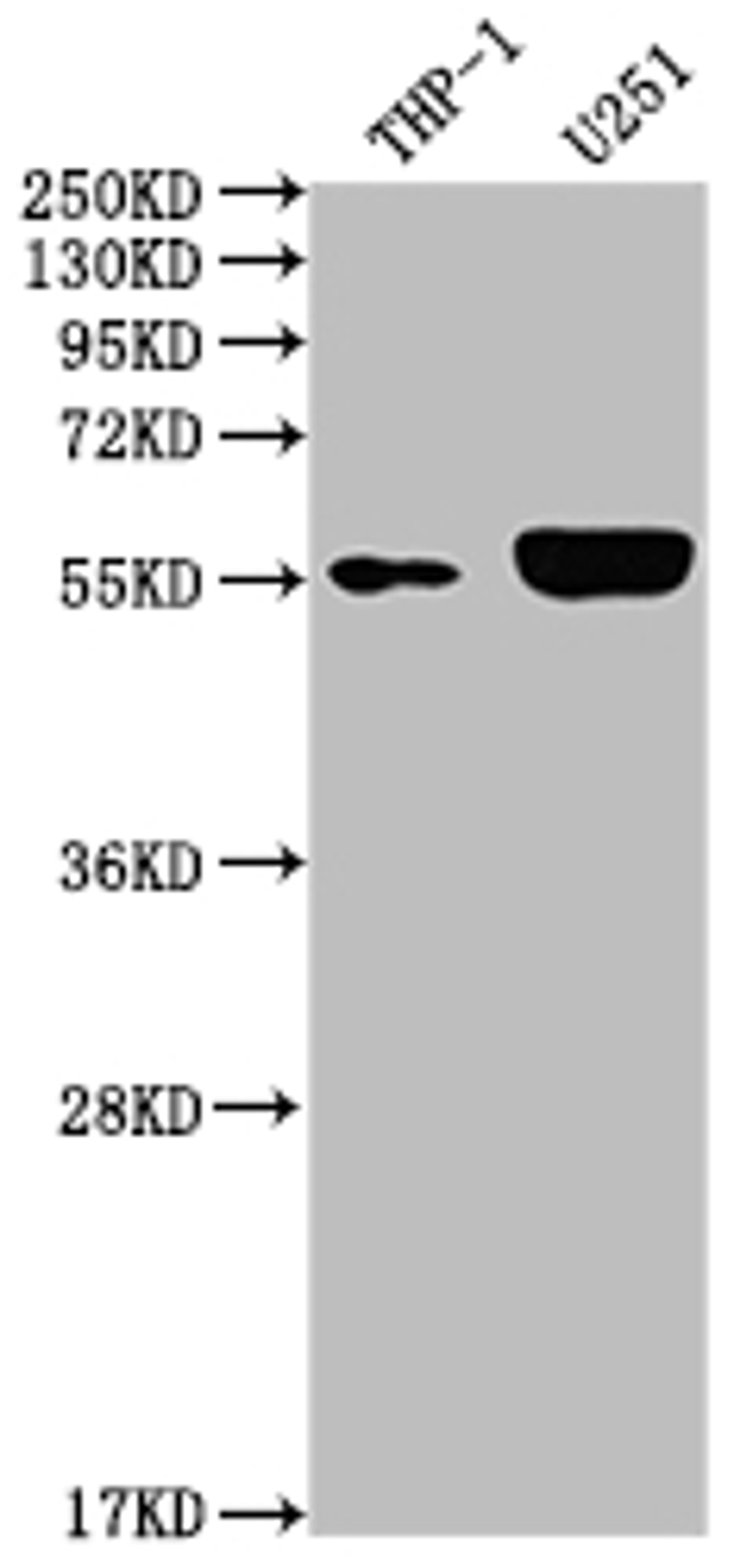 Western Blot. Positive WB detected in: THP-1 whole cell lysate, U251 whole cell lysate. All lanes: IRAK4 antibody at 1:2000. Secondary. Goat polyclonal to rabbit IgG at 1/50000 dilution. Predicted band size: 52, 38 kDa. Observed band size: 55 kDa.