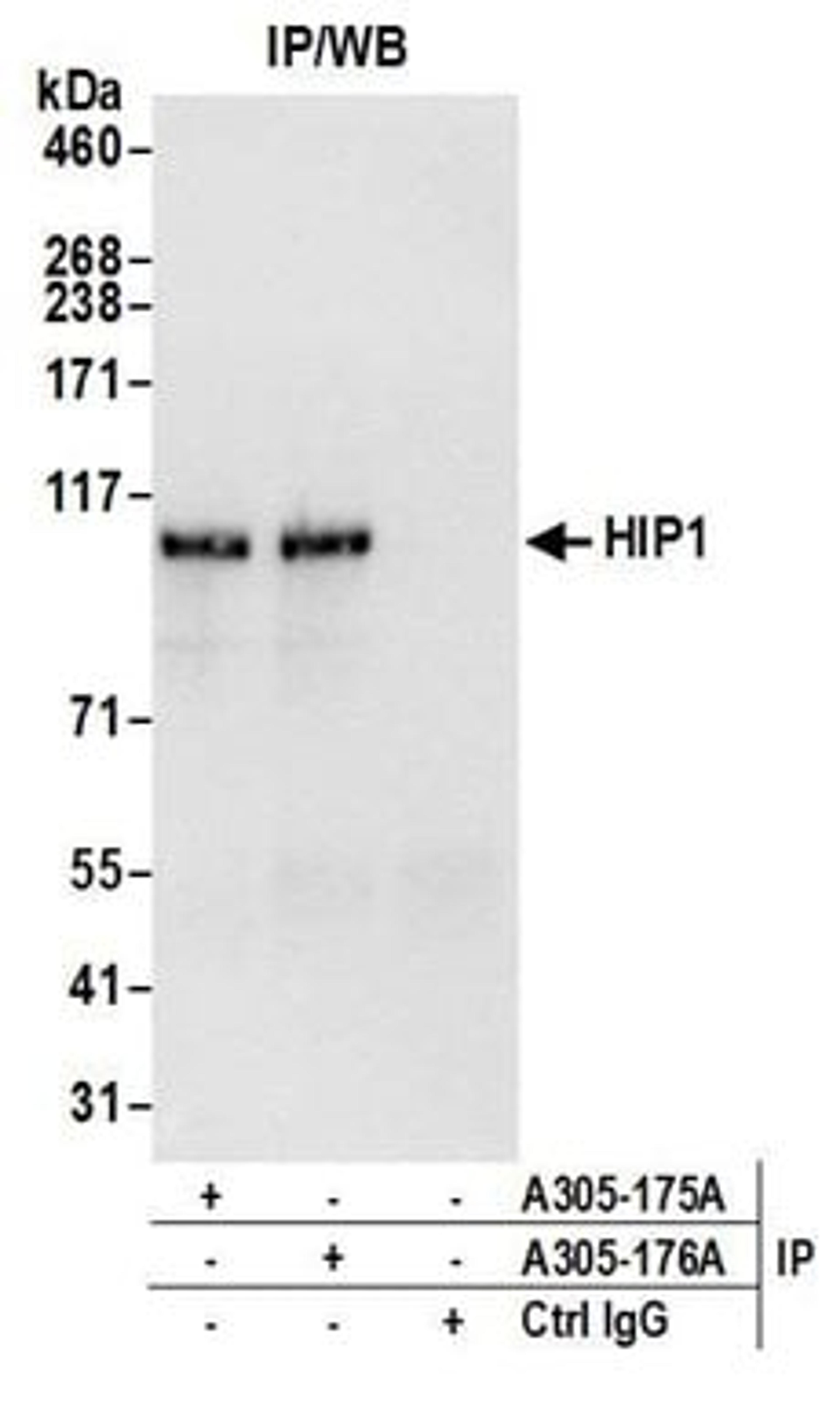 Detection of human HIP1 by western blot of immunoprecipitates.